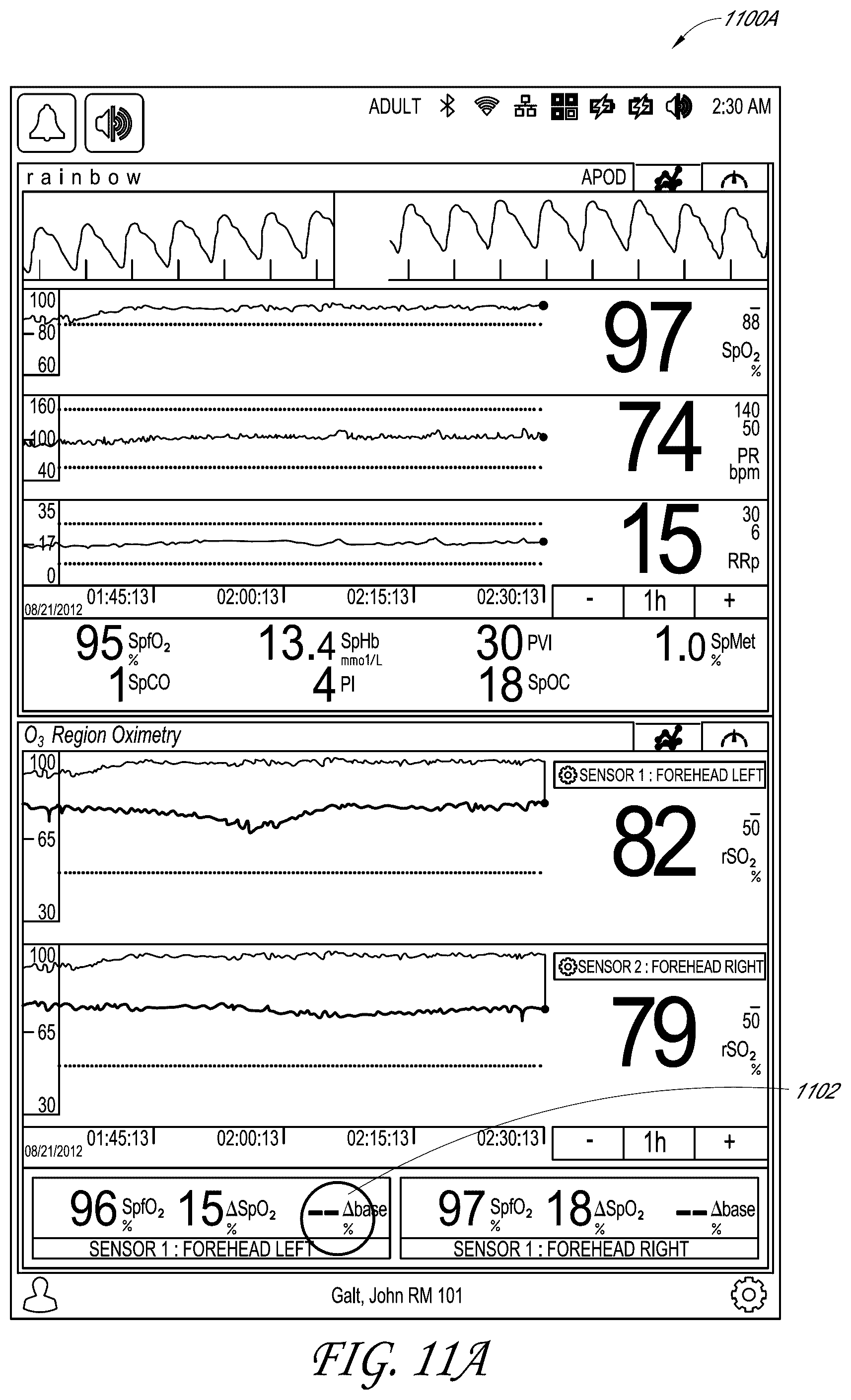 Patent US12318196 Figure 18 – Regional oximetry user interface
