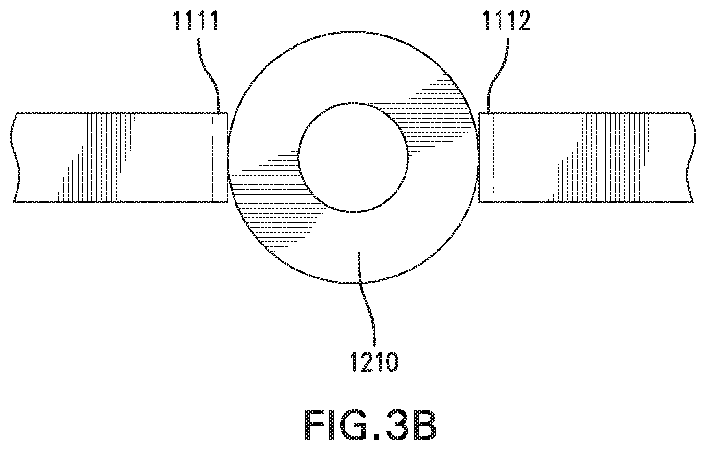 Patent US12318199 Figure 14 – In Vivo sensing and infusion devices