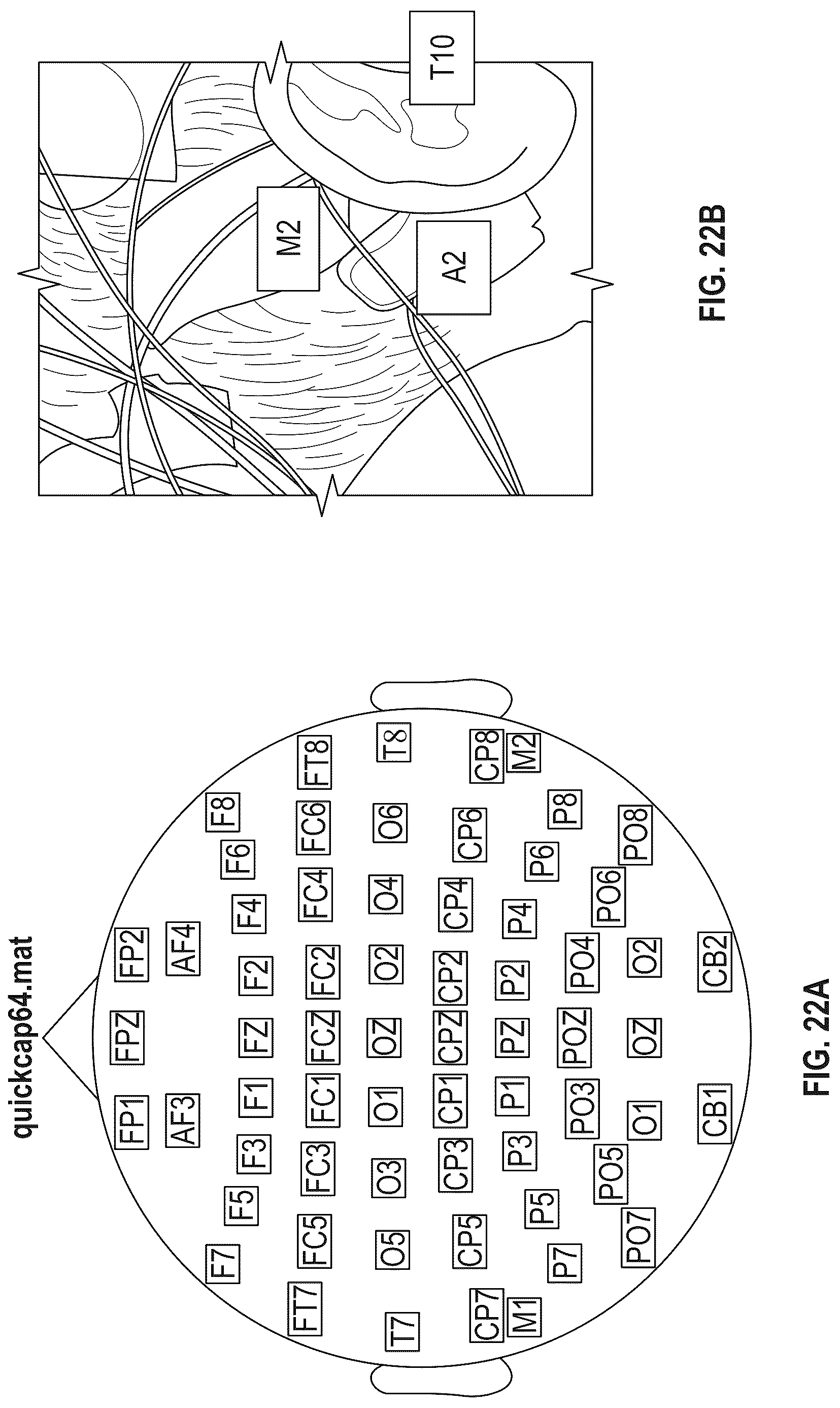 Patent US12318206 Figure 16 – Blood glucose states based on sensed brain activity
