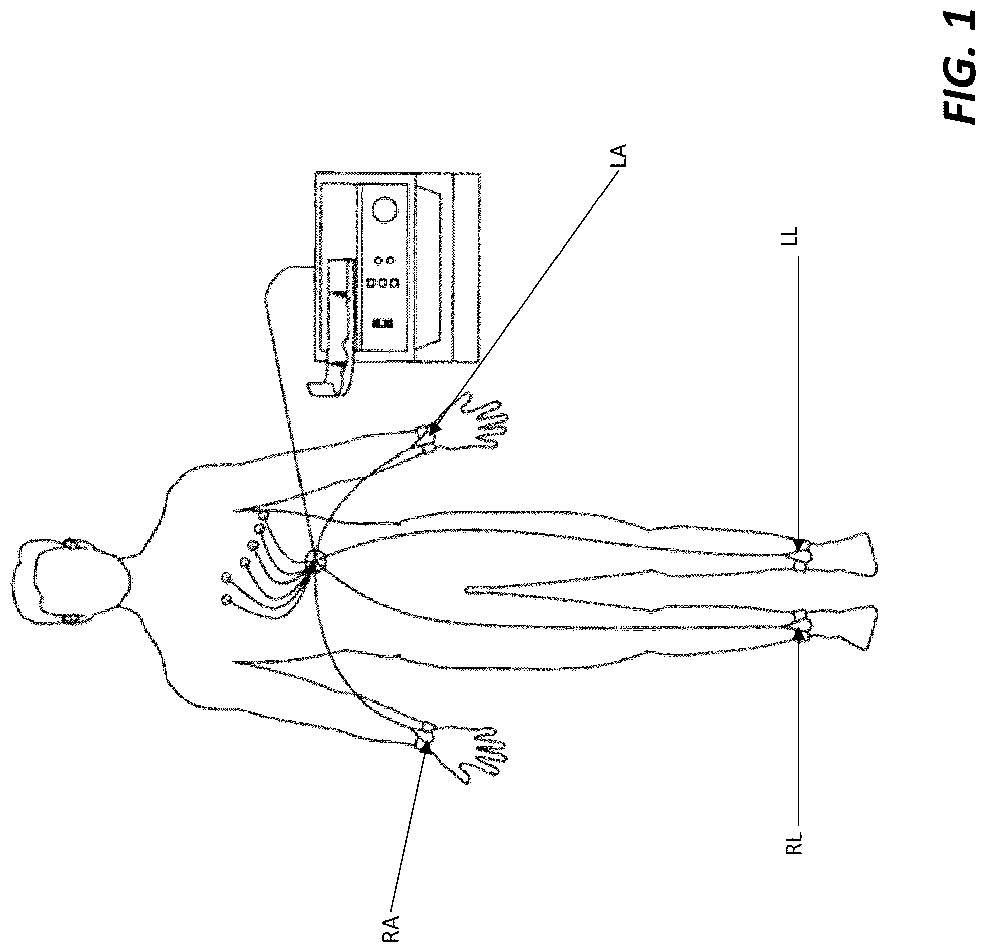 Patent US12318208 Figure 1 – Two-lead QT interval prediction