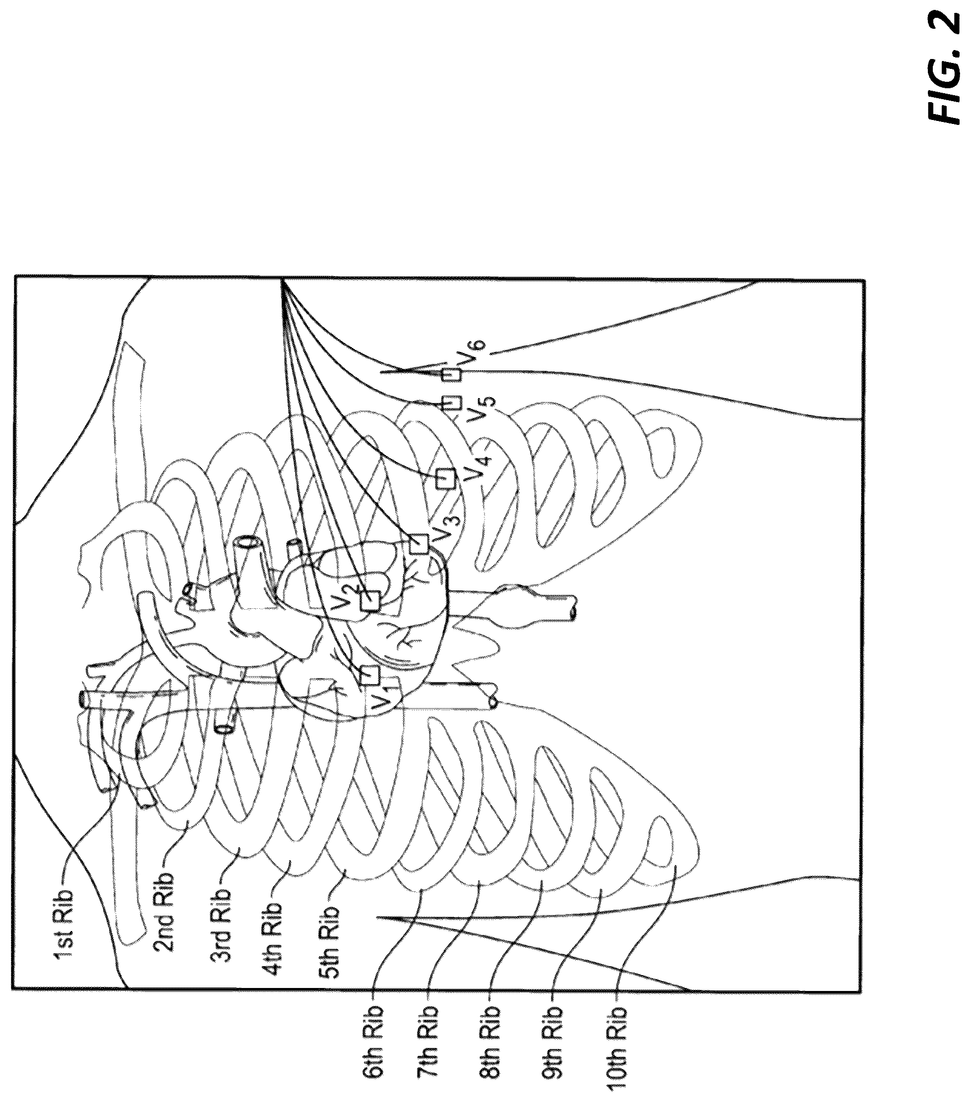 Patent US12318208 Figure 2 – Two-lead QT interval prediction