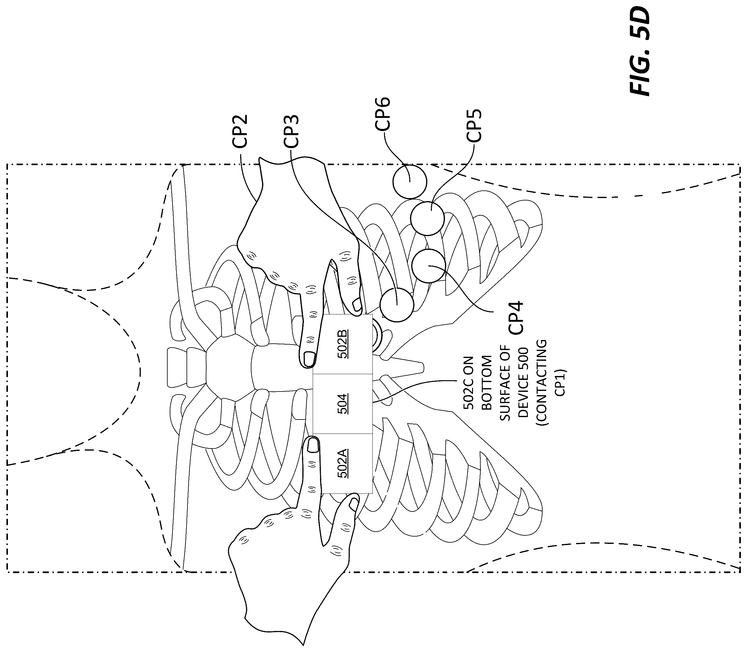 Patent US12318208 Figure 8 – Two-lead QT interval prediction