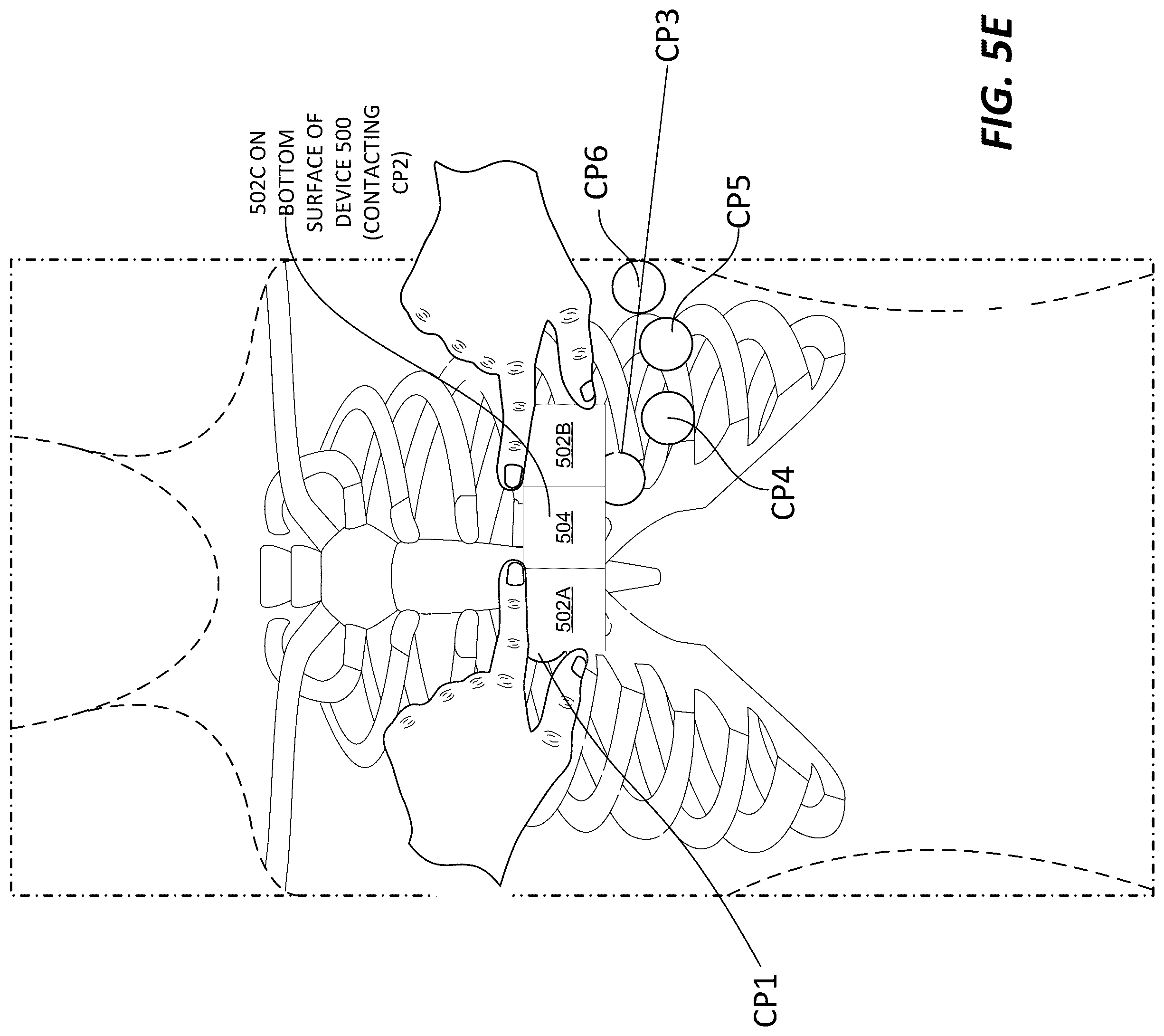 Patent US12318208 Figure 9 – Two-lead QT interval prediction