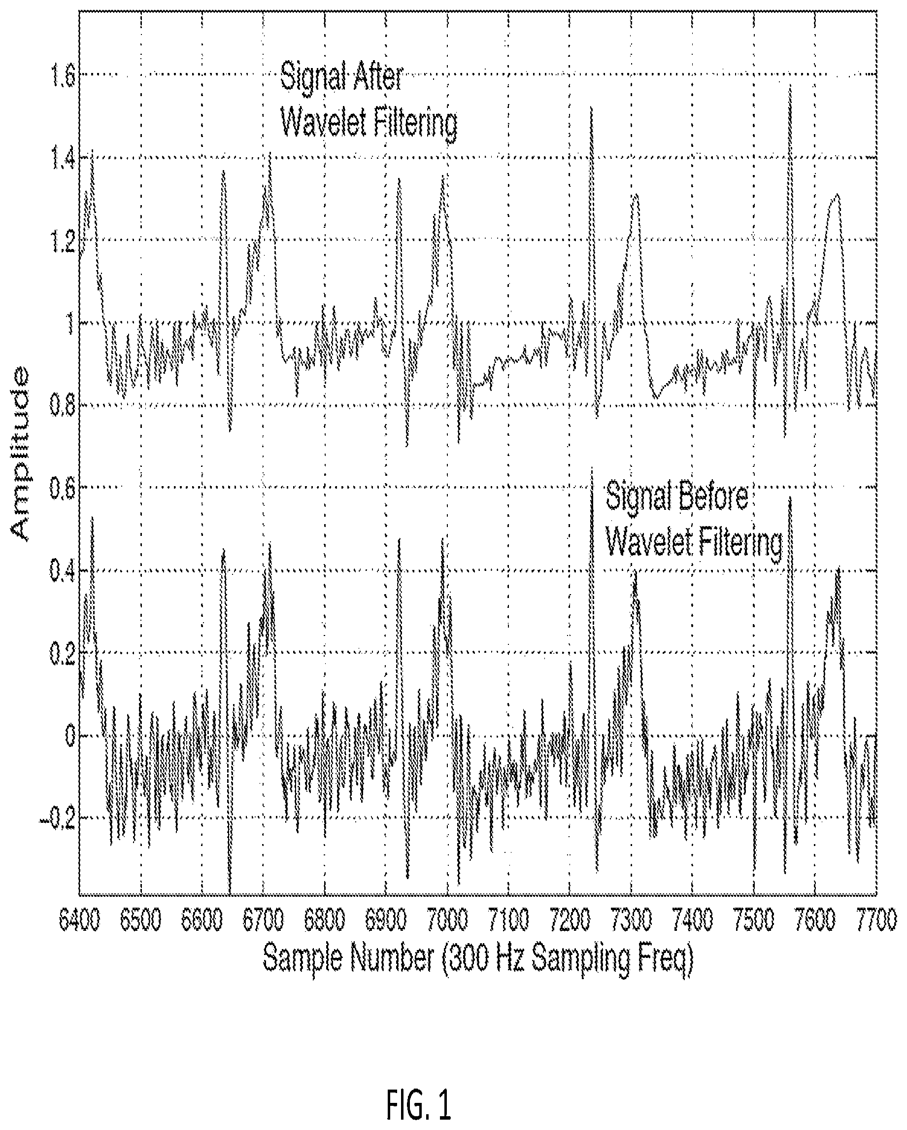 Patent US12318209 Figure 1 – Electrocardiogram signal detection