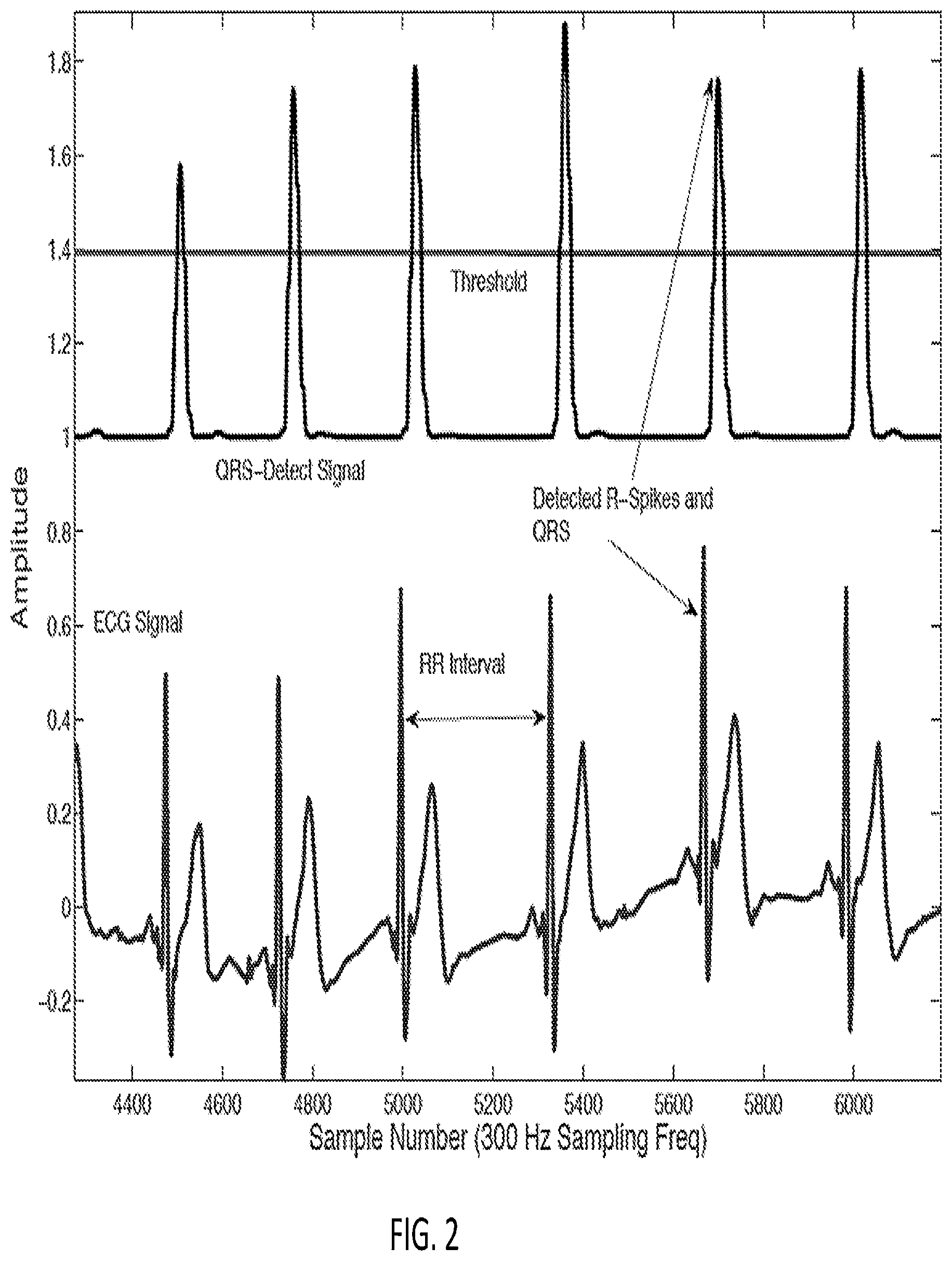 Patent US12318209 Figure 2 – Electrocardiogram signal detection