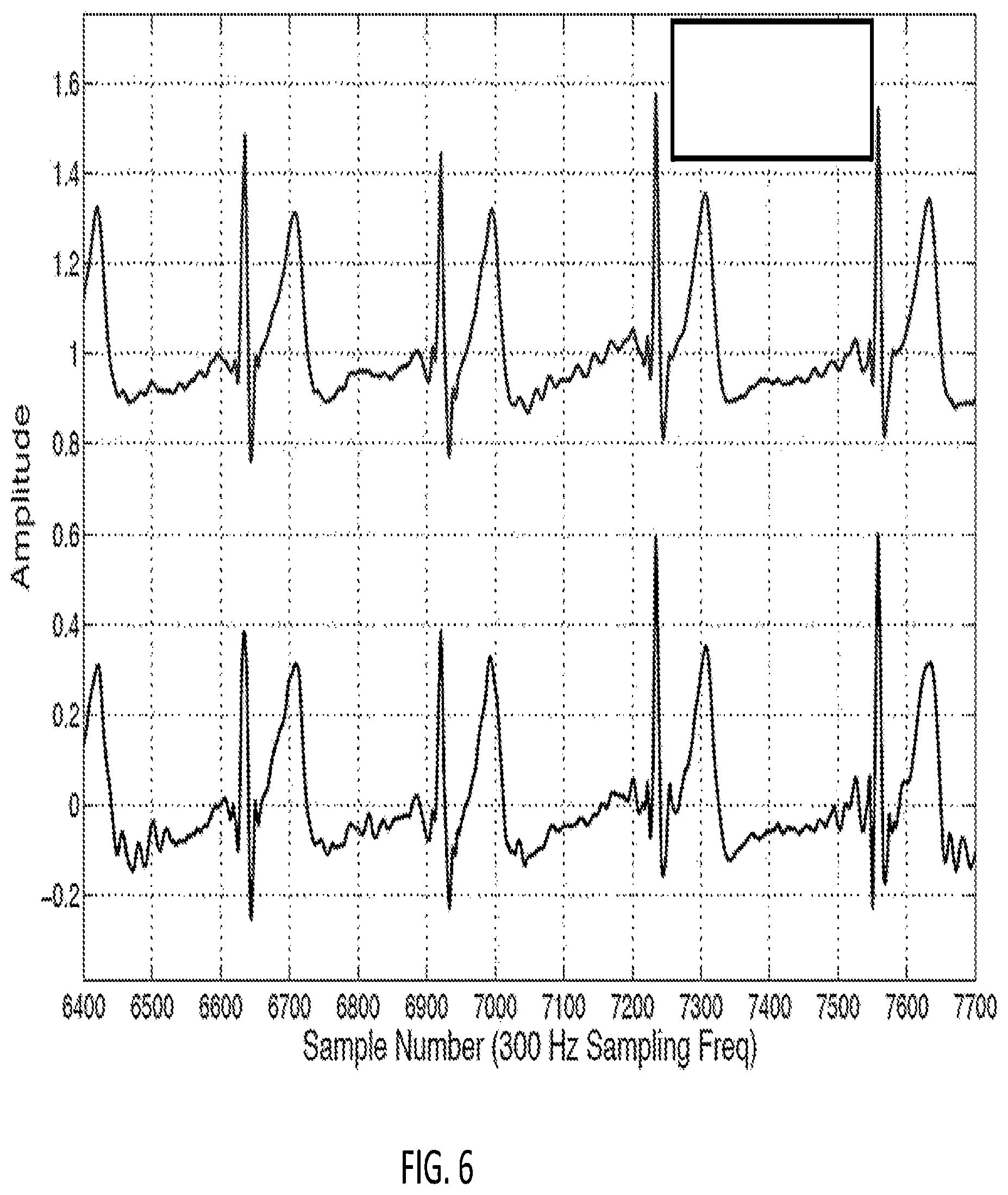 Patent US12318209 Figure 6 – Electrocardiogram signal detection