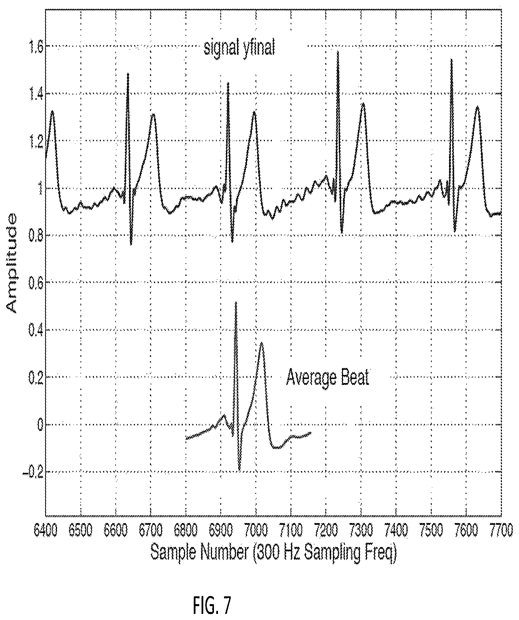 Patent US12318209 Figure 7 – Electrocardiogram signal detection