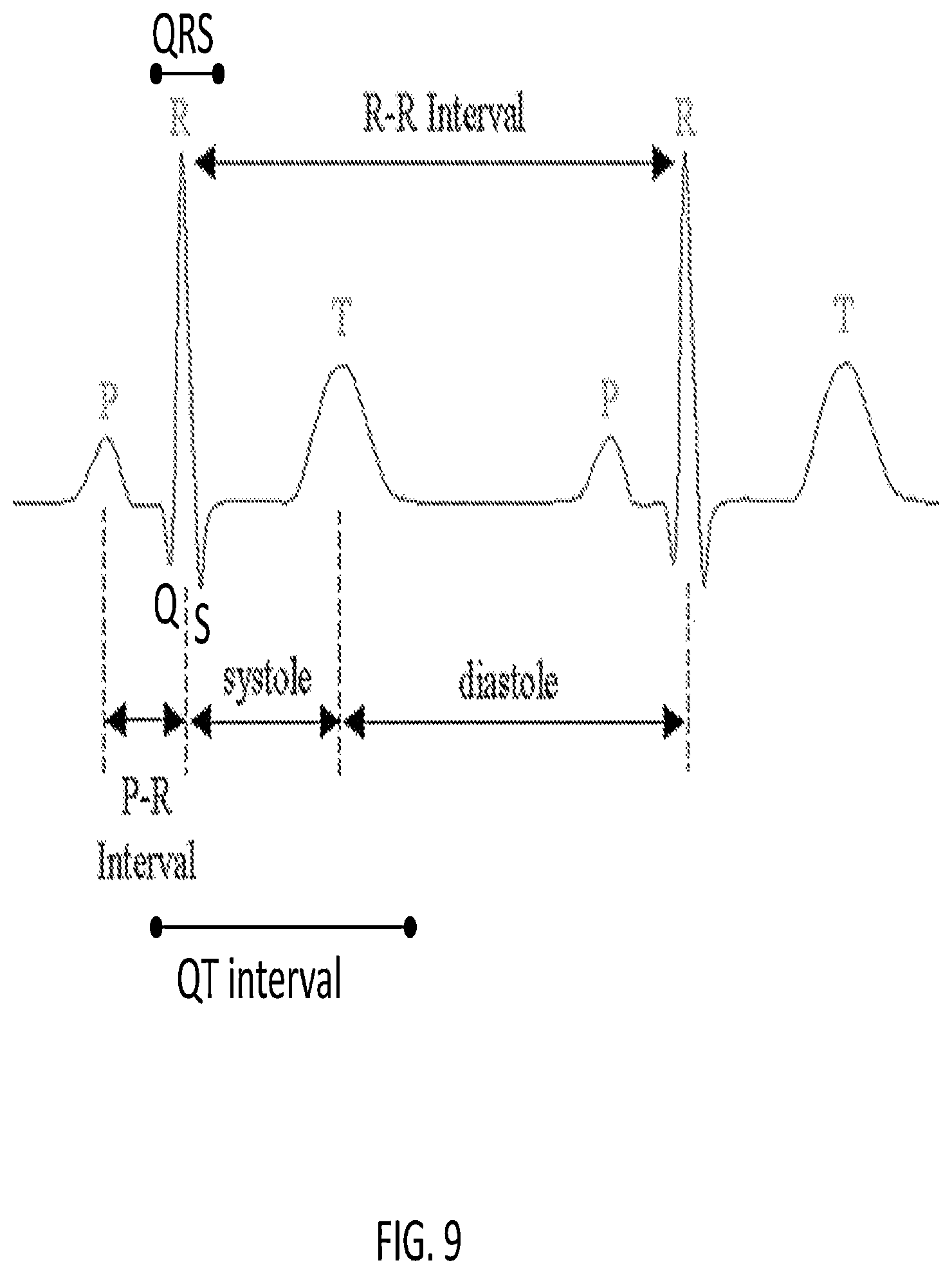 Patent US12318209 Figure 9 – Electrocardiogram signal detection