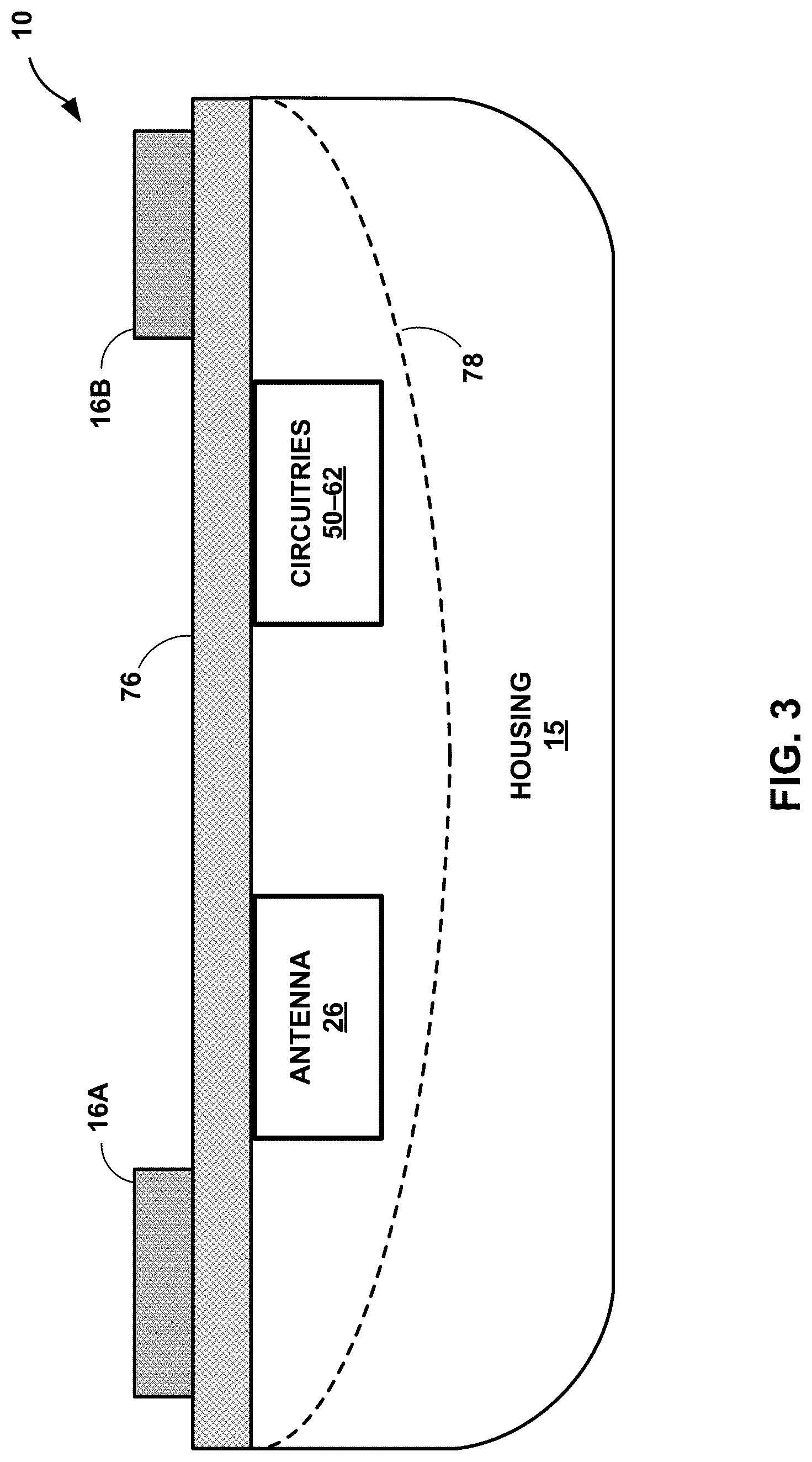 Patent US12318210 Figure 3 – Premature ventricular contraction (PVC) detection