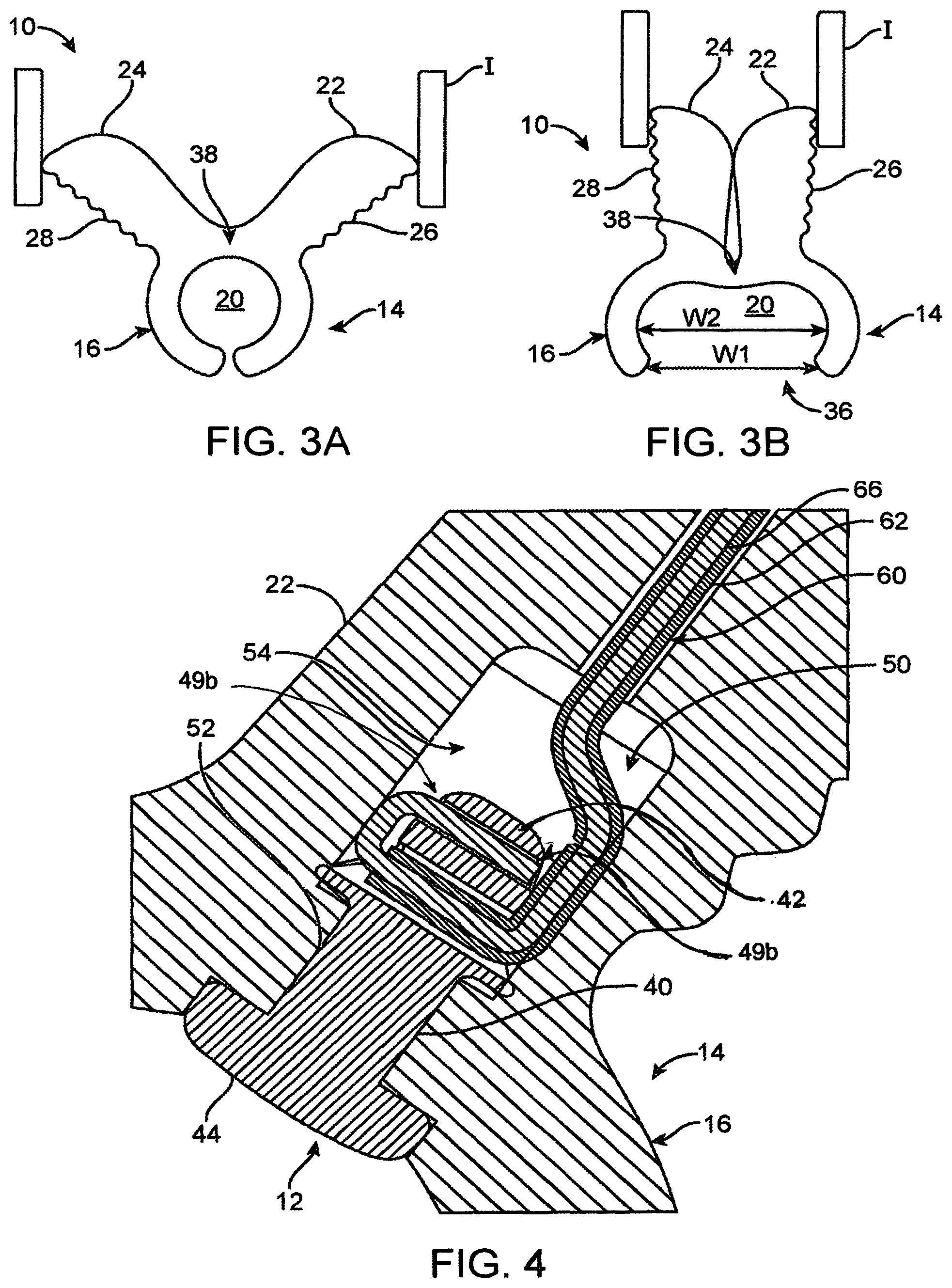 Patent US12318212 Figure 2 – Nerve monitoring and/or stimulation electrode assemblies