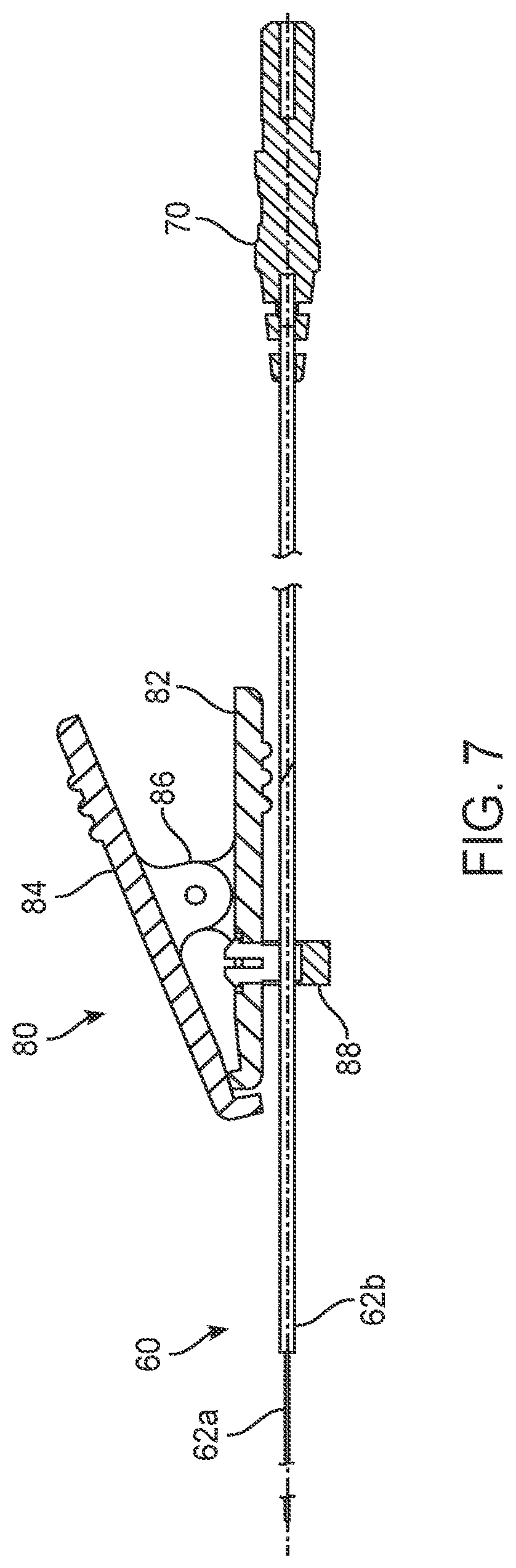 Patent US12318212 Figure 5 – Nerve monitoring and/or stimulation electrode assemblies