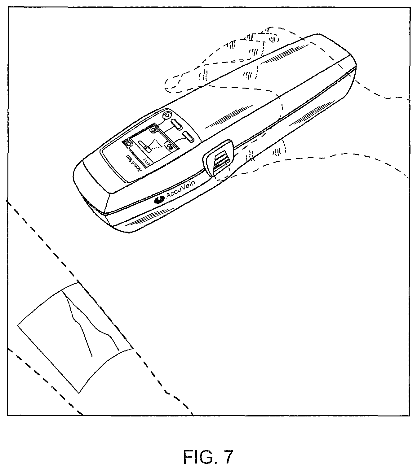 Patent US12318219 Figure 7 – Vein scanner with limited photodiode FOV moving synchronously with scanned laser light