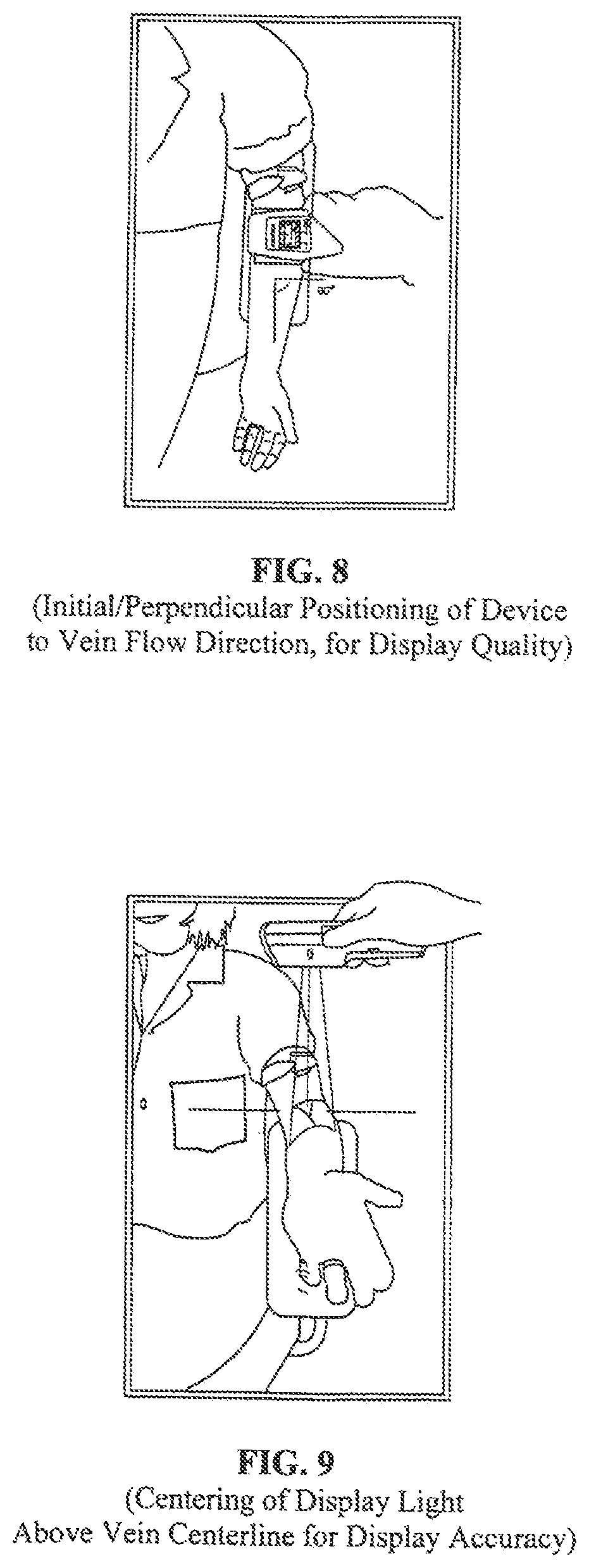 Patent US12318219 Figure 8 – Vein scanner with limited photodiode FOV moving synchronously with scanned laser light