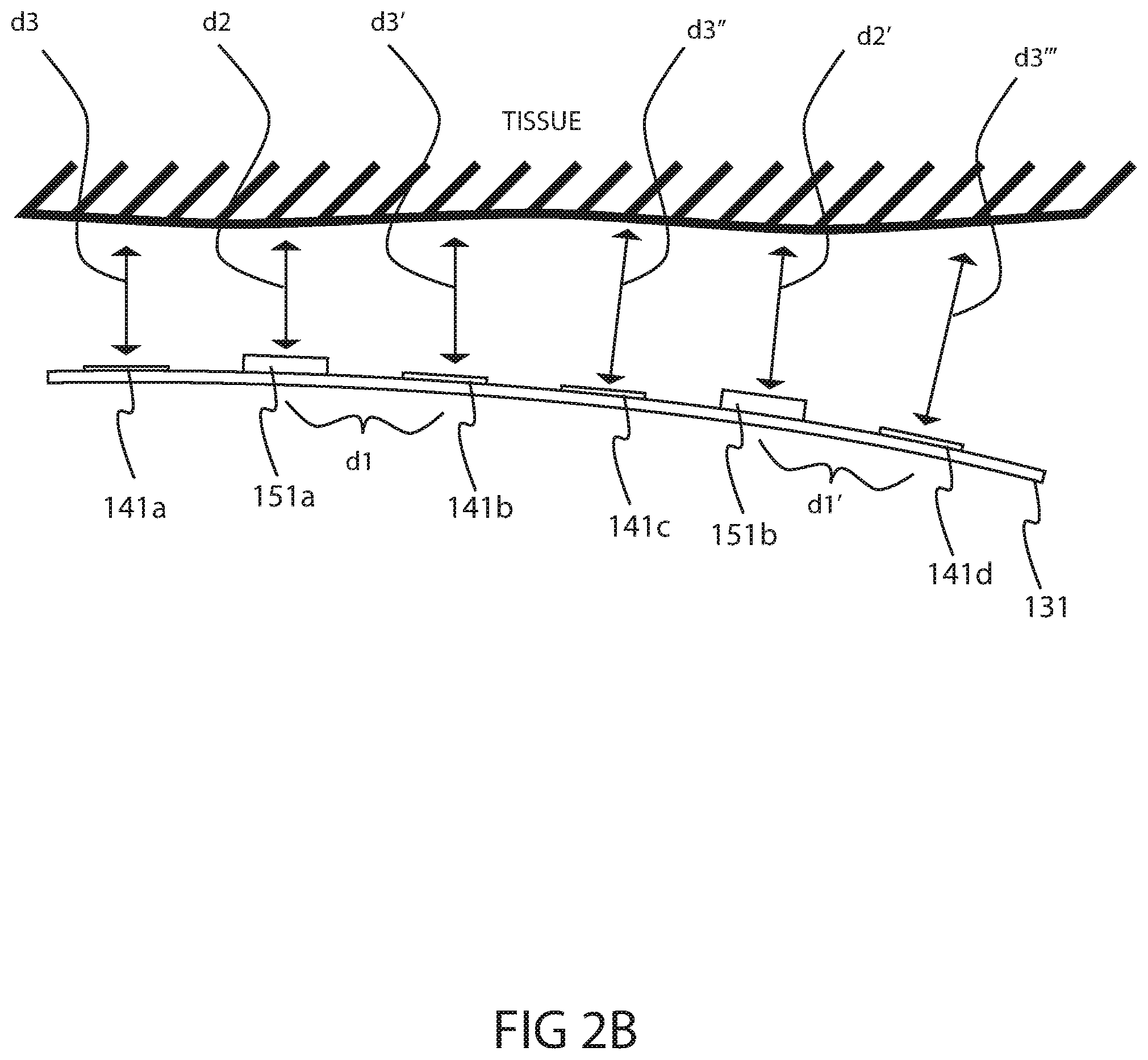 Patent US12318225 Figure 5 – Catheter system and methods of medical uses of same, including diagnostic and treatment uses for the heart