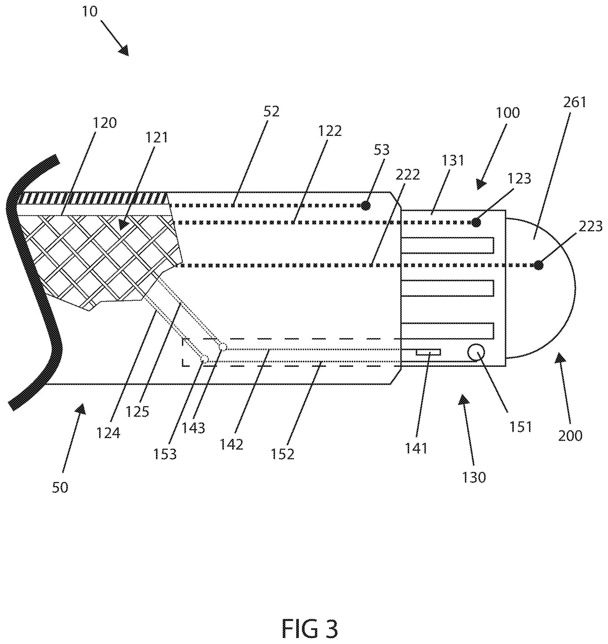 Patent US12318225 Figure 6 – Catheter system and methods of medical uses of same, including diagnostic and treatment uses for the heart