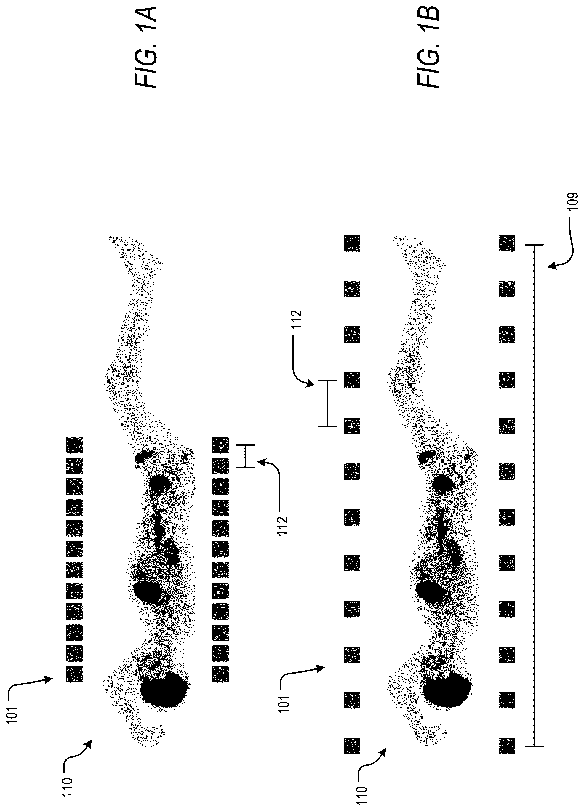 Patent US12318232 Figure 1 – Pet reconstruction for adjustable pet system