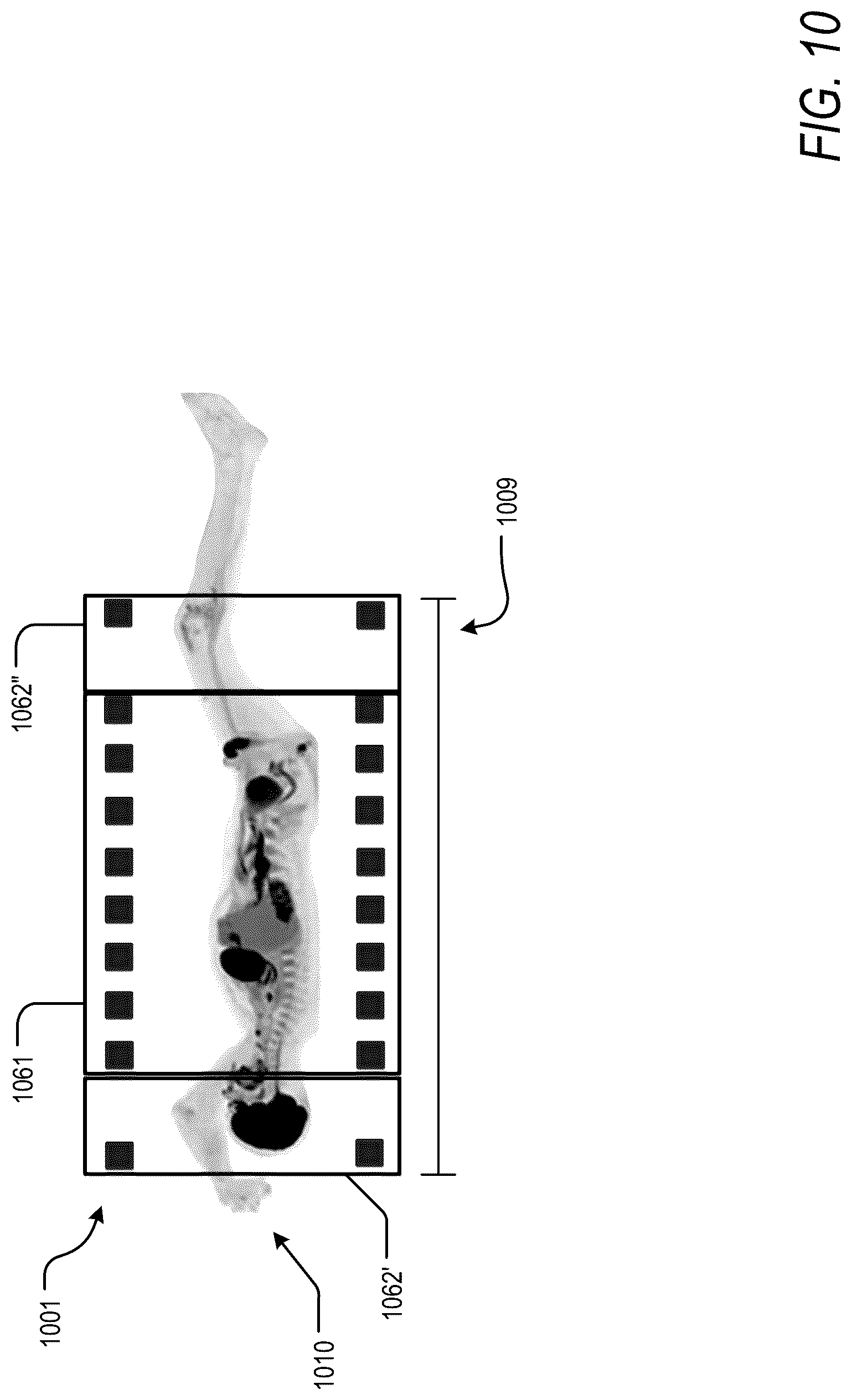 Patent US12318232 Figure 15 – Pet reconstruction for adjustable pet system