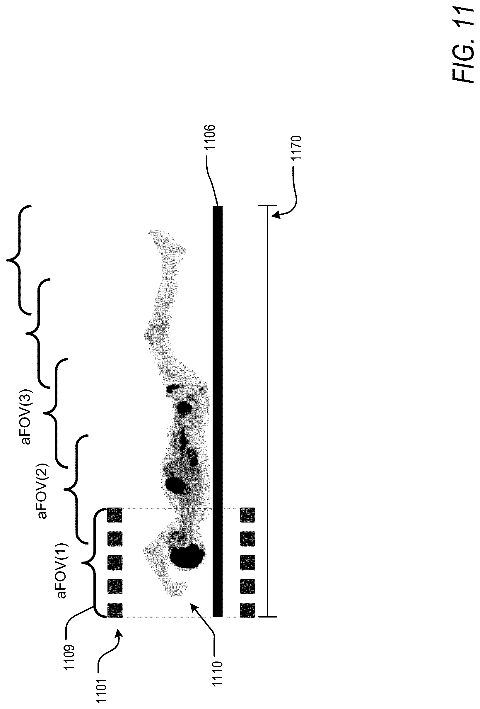 Patent US12318232 Figure 16 – Pet reconstruction for adjustable pet system