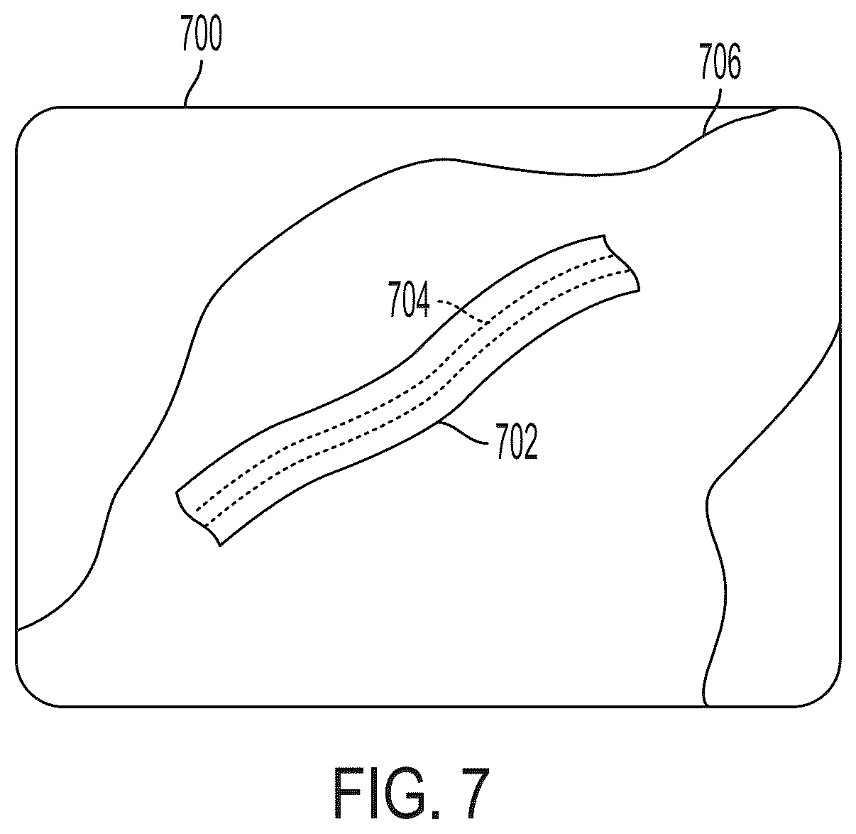 Patent US12318234 Figure 7 – Systems and methods for persistent ureter visualization