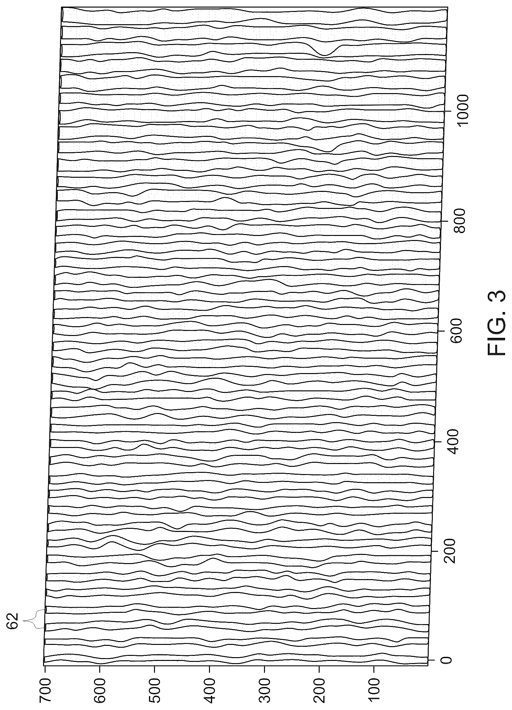 Patent US12318238 Figure 3 – System and method for deep-learning based estimation of coronary artery pressure drop