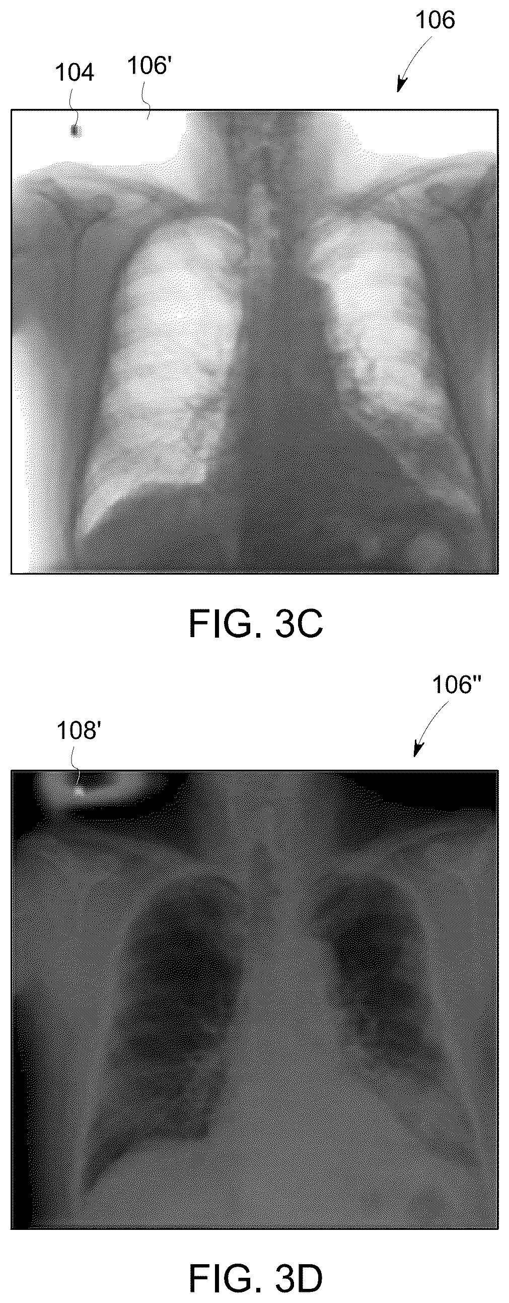 Patent US12318239 Figure 4 – X-ray lead marker detection system for x-ray imaging system