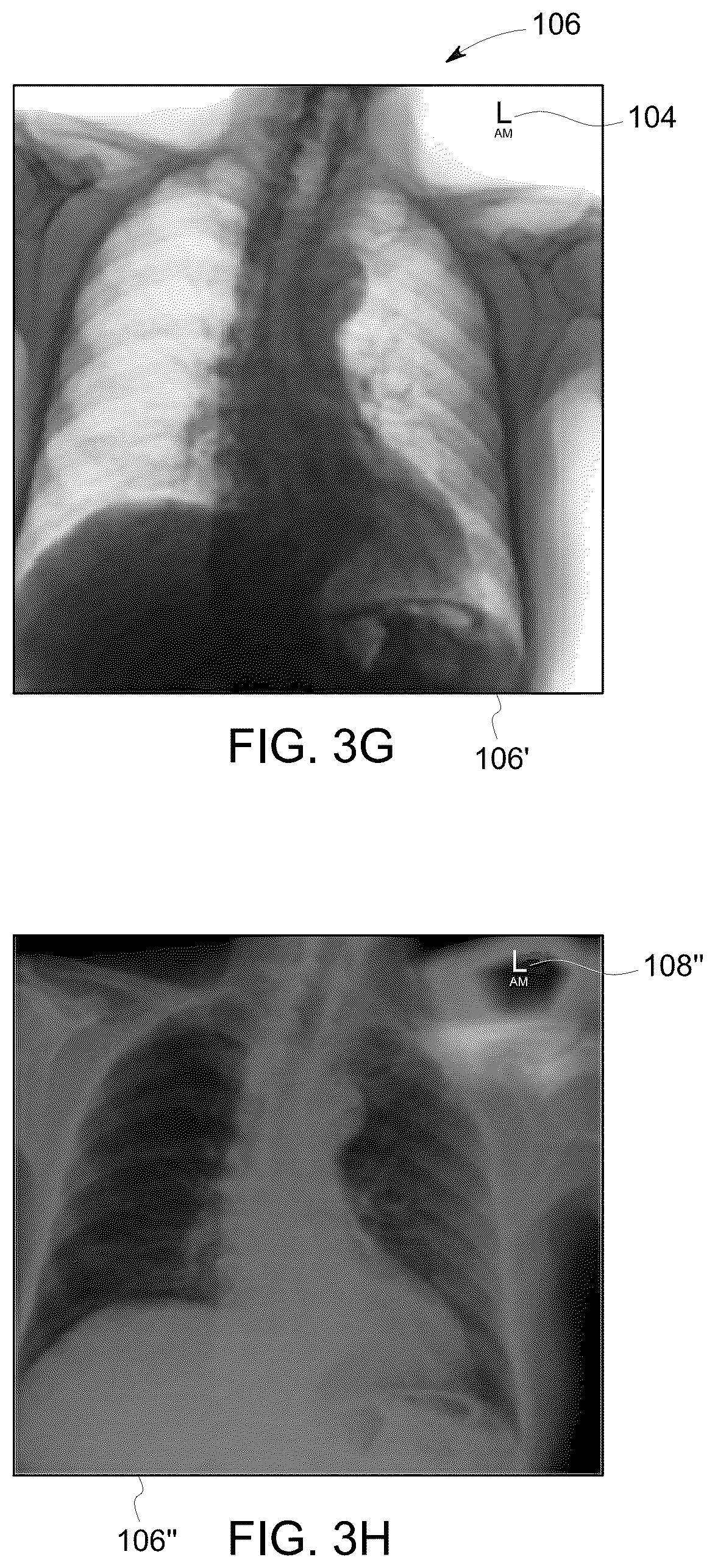 Patent US12318239 Figure 6 – X-ray lead marker detection system for x-ray imaging system