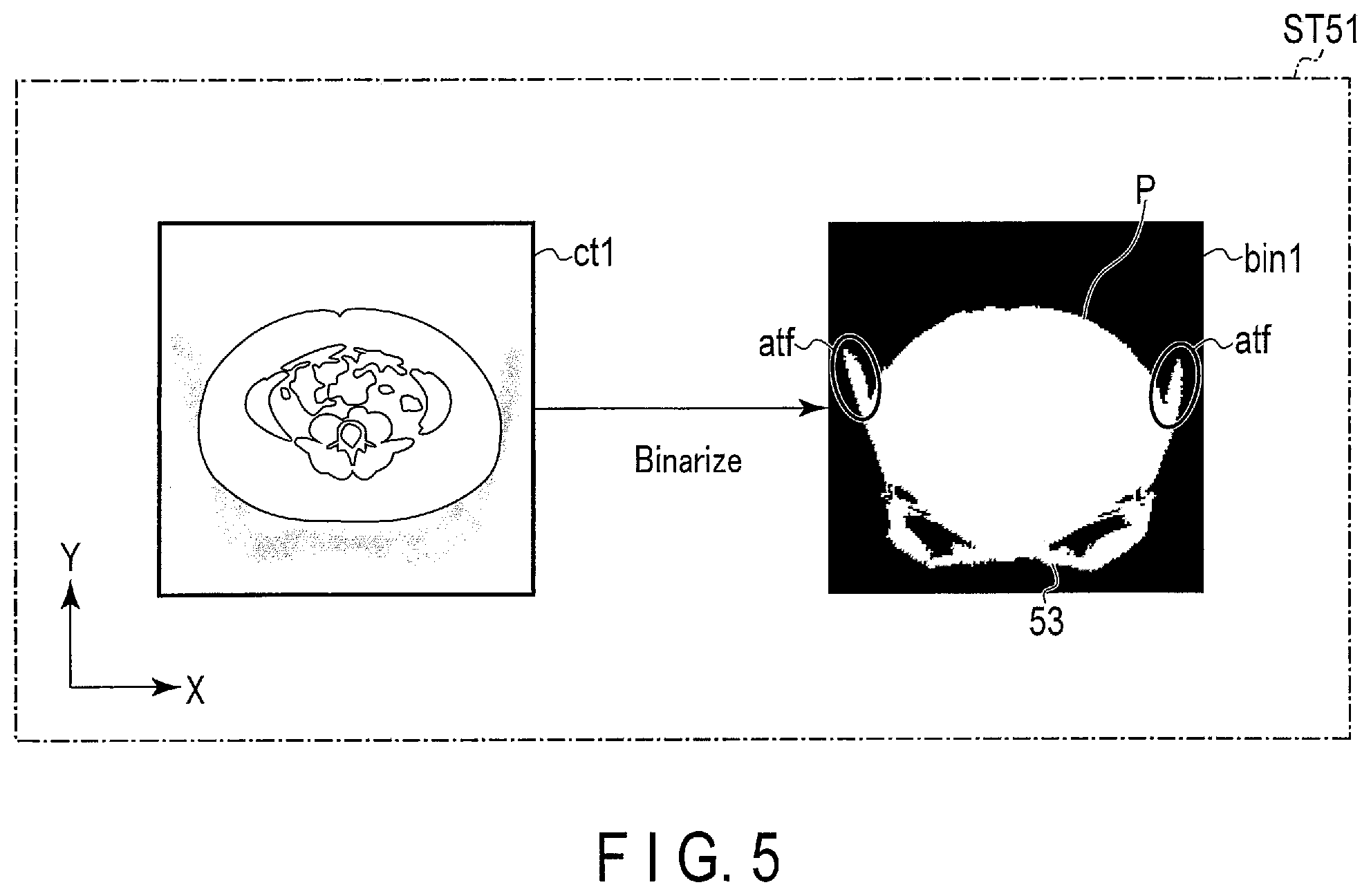 Patent US12318240 Figure 5 – Nuclear medicine diagnostic apparatus, nuclear medicine diagnostic method, and storage medium