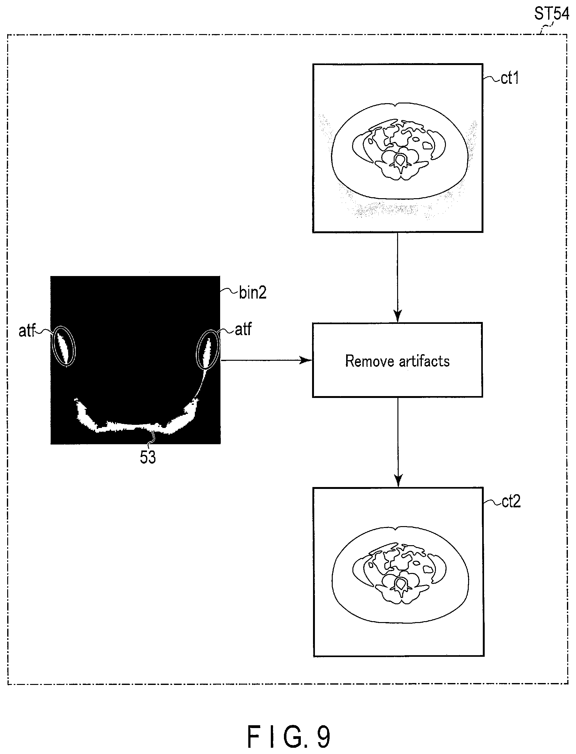 Patent US12318240 Figure 9 – Nuclear medicine diagnostic apparatus, nuclear medicine diagnostic method, and storage medium