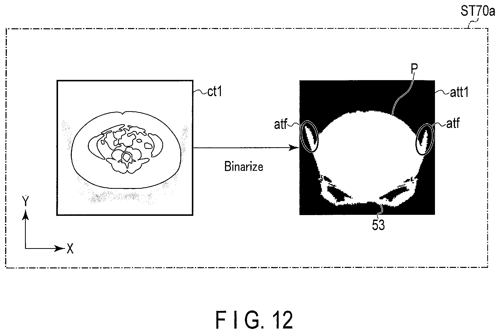 Patent US12318240 Figure 12 – Nuclear medicine diagnostic apparatus, nuclear medicine diagnostic method, and storage medium