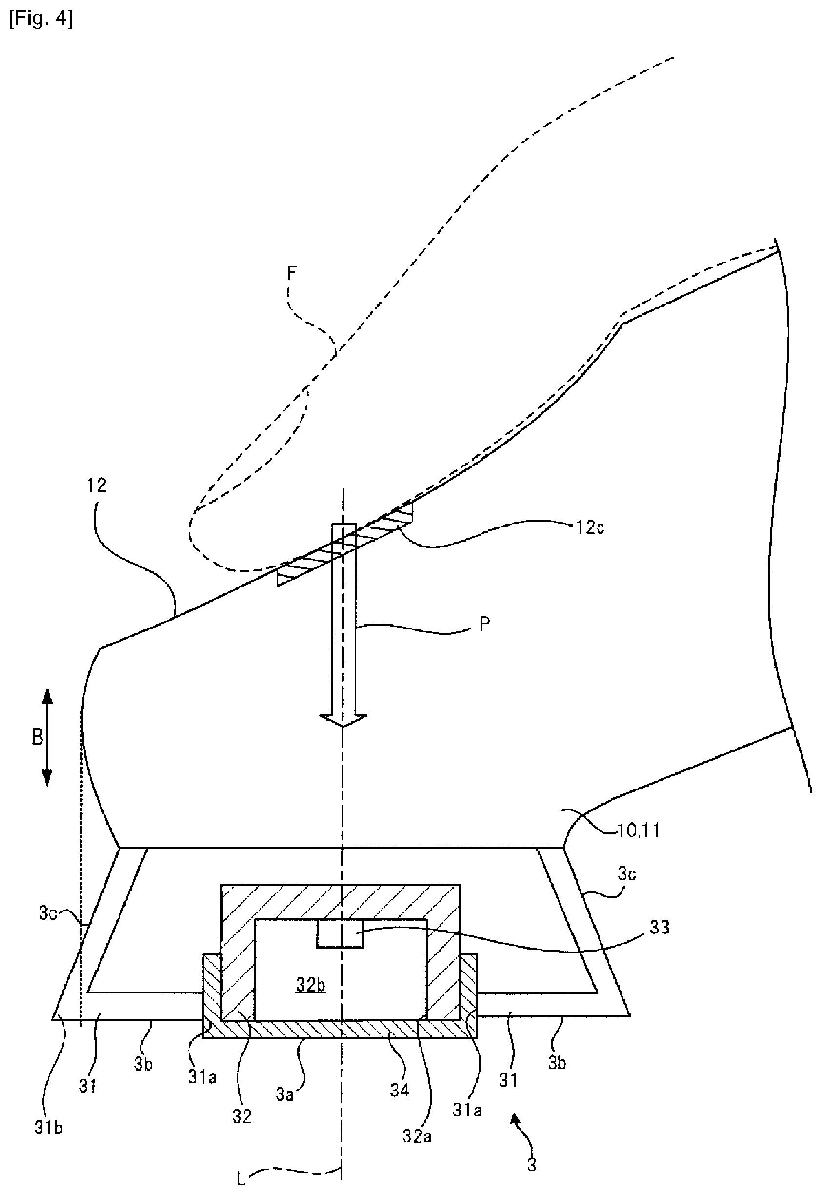 Patent US12318241 Figure 4 – Biological sound measurement device