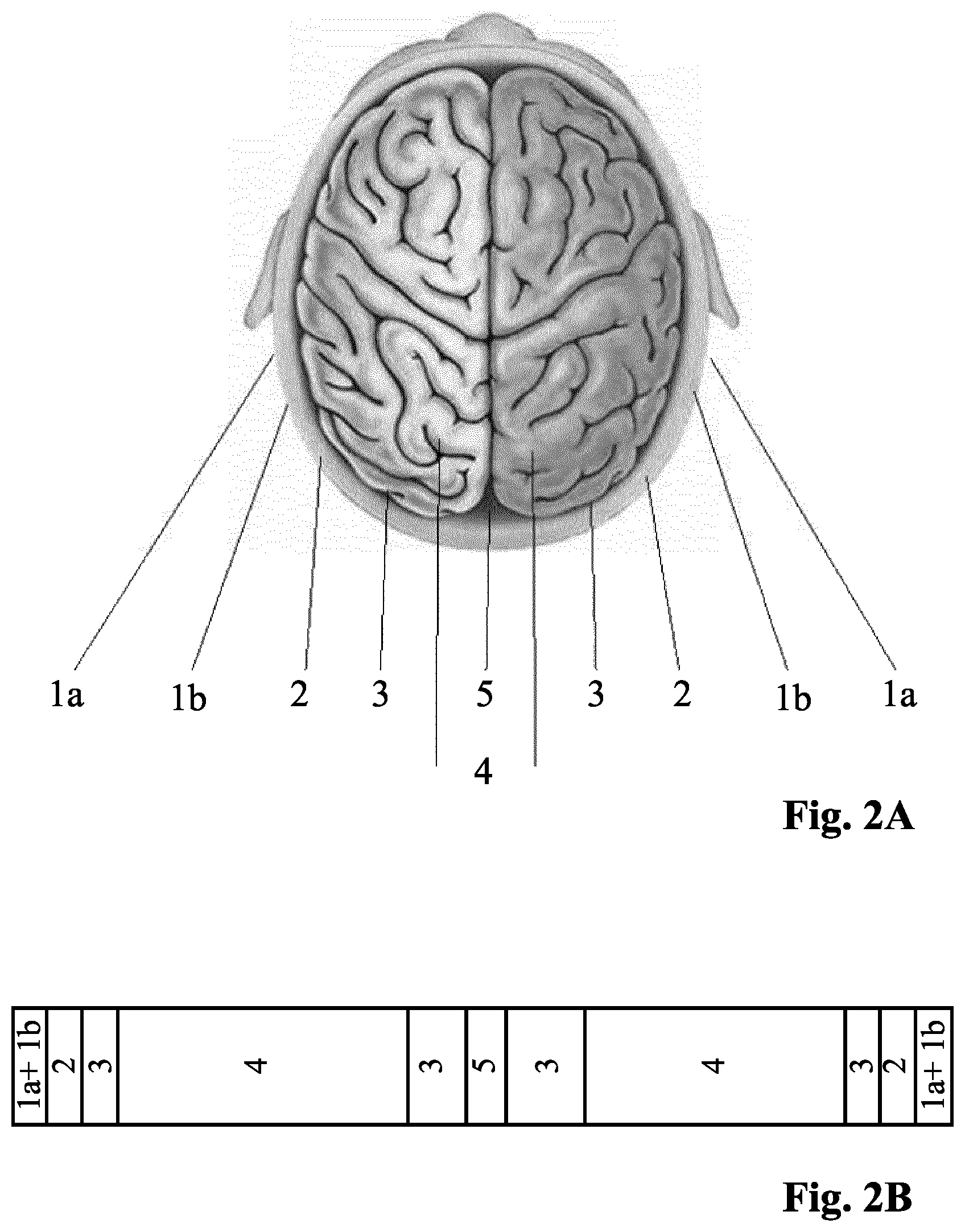 Patent US12318242 Figure 2 – Method and device for a non-invasive determination and/or monitoring of intracranial compliance