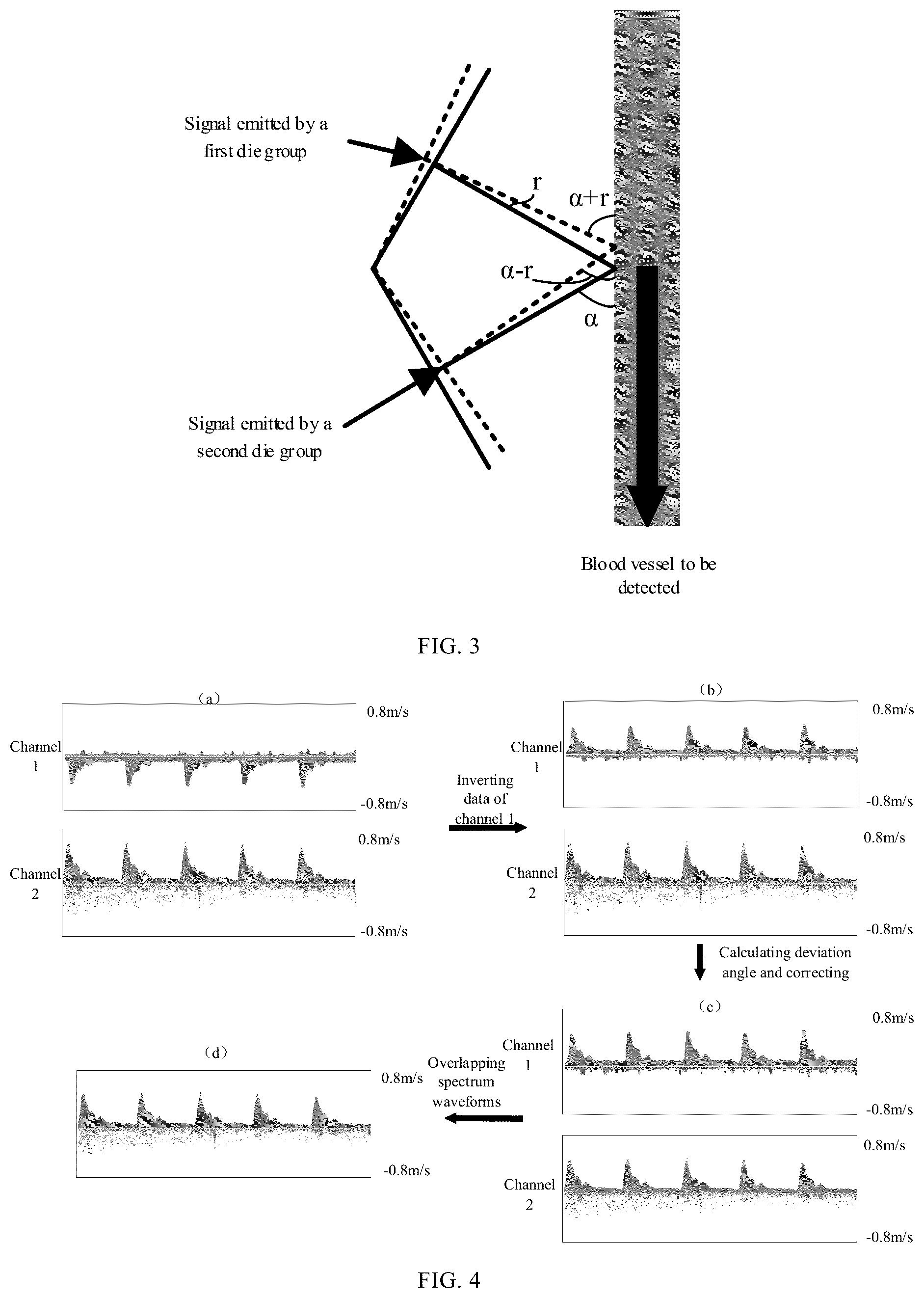 Patent US12318243 Figure 2 – Method for determining blood flow velocity using dual die group and doppler blood flow detection device