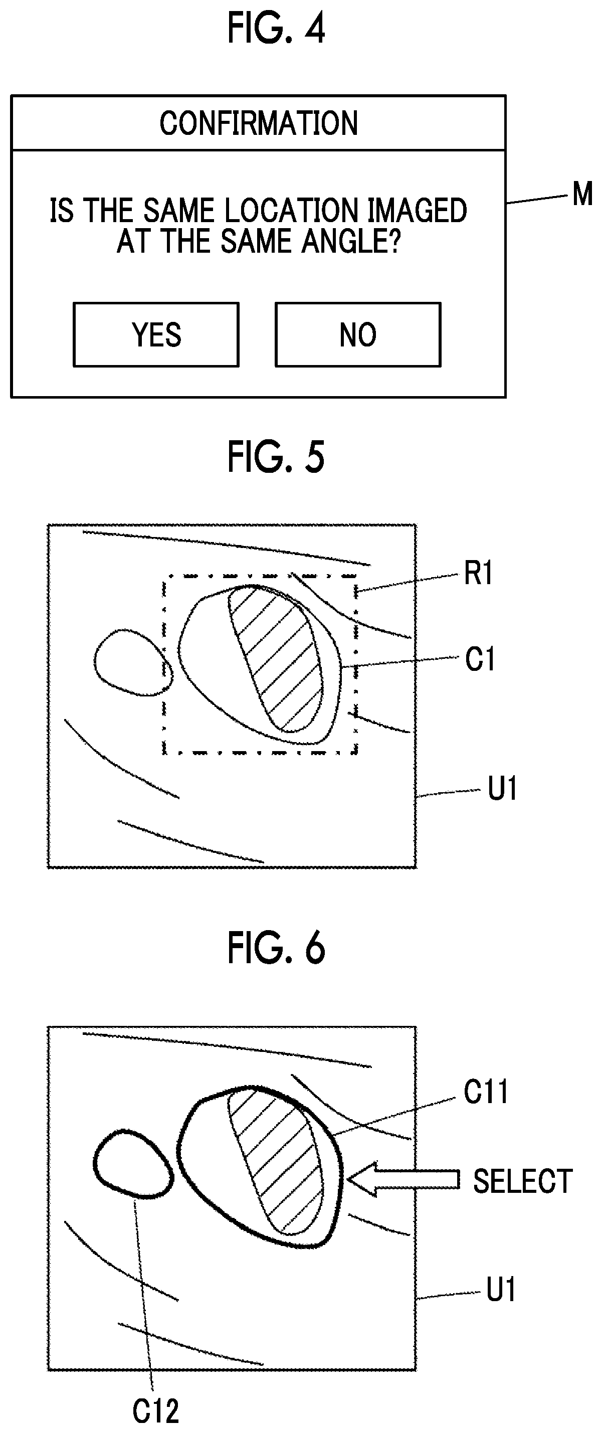 Patent US12318244 Figure 3 – Ultrasound diagnostic apparatus and control method of ultrasound diagnostic apparatus