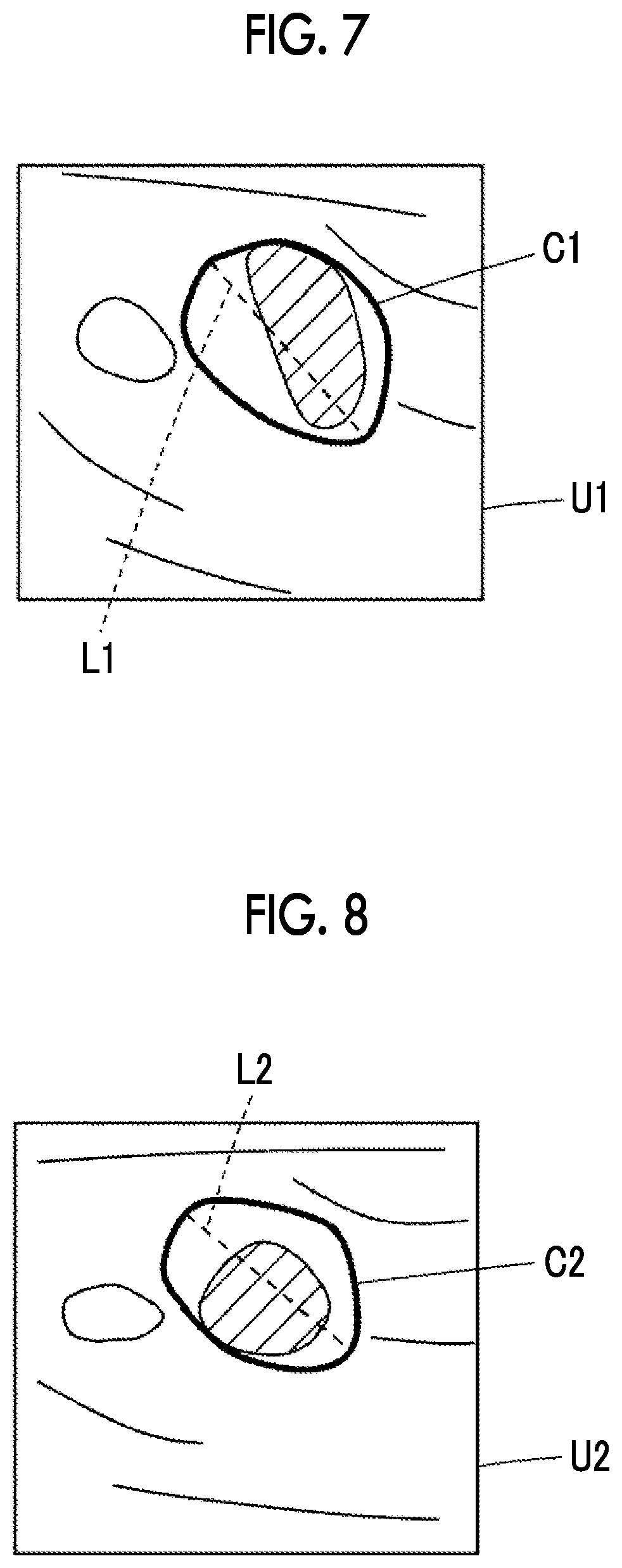 Patent US12318244 Figure 4 – Ultrasound diagnostic apparatus and control method of ultrasound diagnostic apparatus
