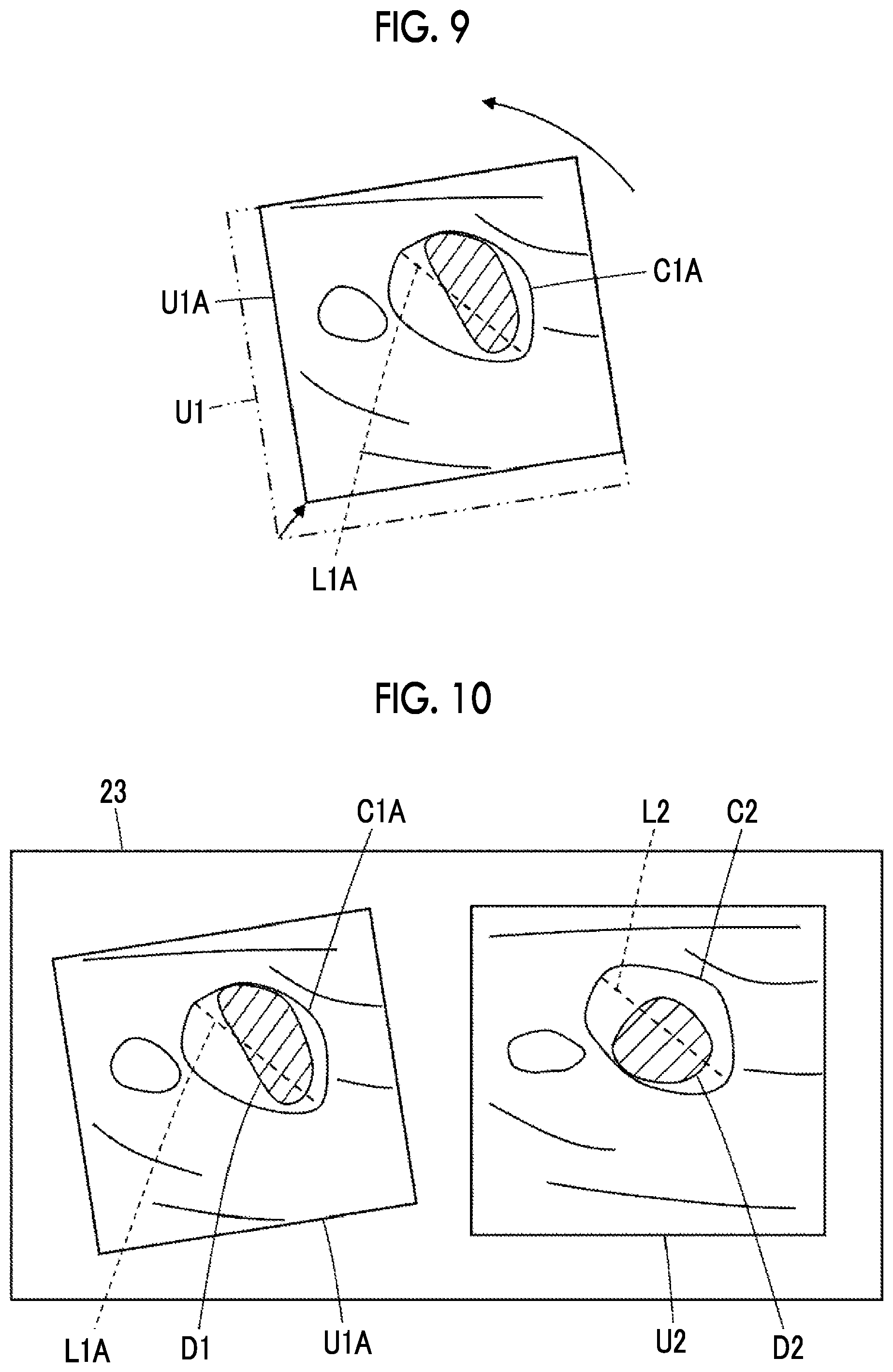 Patent US12318244 Figure 5 – Ultrasound diagnostic apparatus and control method of ultrasound diagnostic apparatus