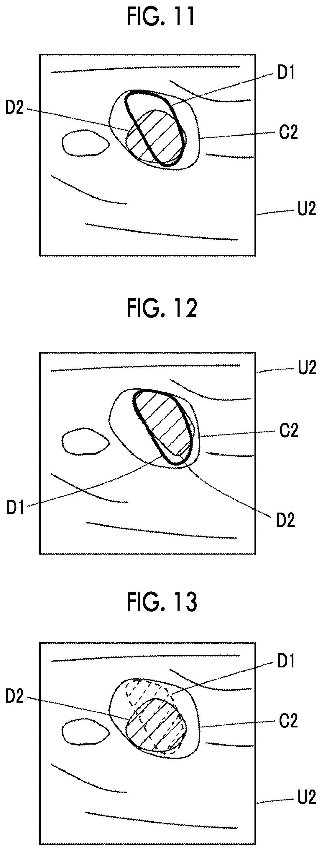Patent US12318244 Figure 6 – Ultrasound diagnostic apparatus and control method of ultrasound diagnostic apparatus
