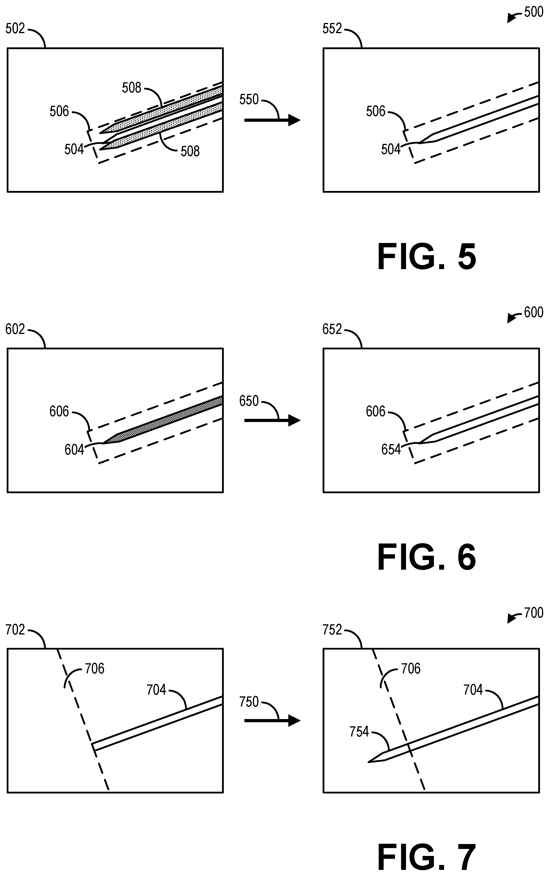 Patent US12318245 Figure 5 – Methods and systems for imaging a needle from ultrasound imaging data
