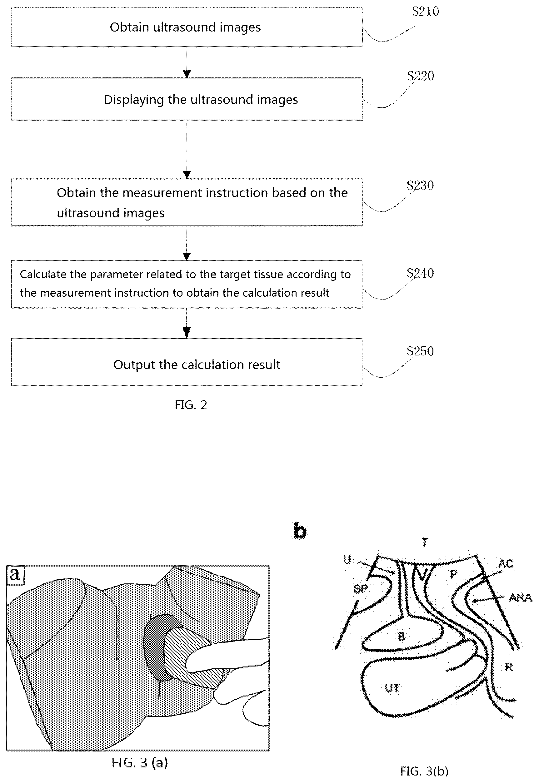 Patent US12318246 Figure 2 – Method for measuring parameters in ultrasonic image and ultrasonic imaging system