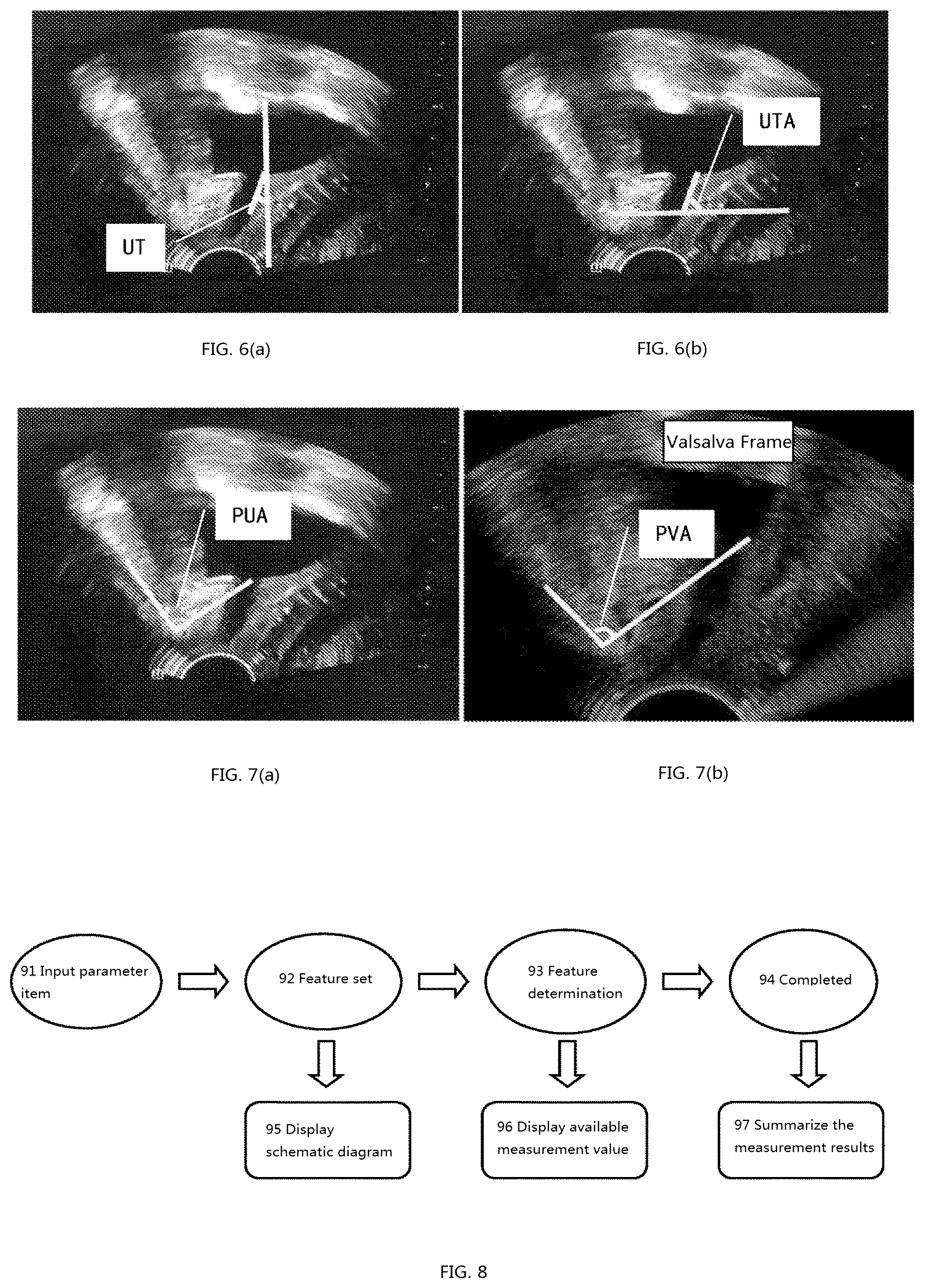 Patent US12318246 Figure 4 – Method for measuring parameters in ultrasonic image and ultrasonic imaging system