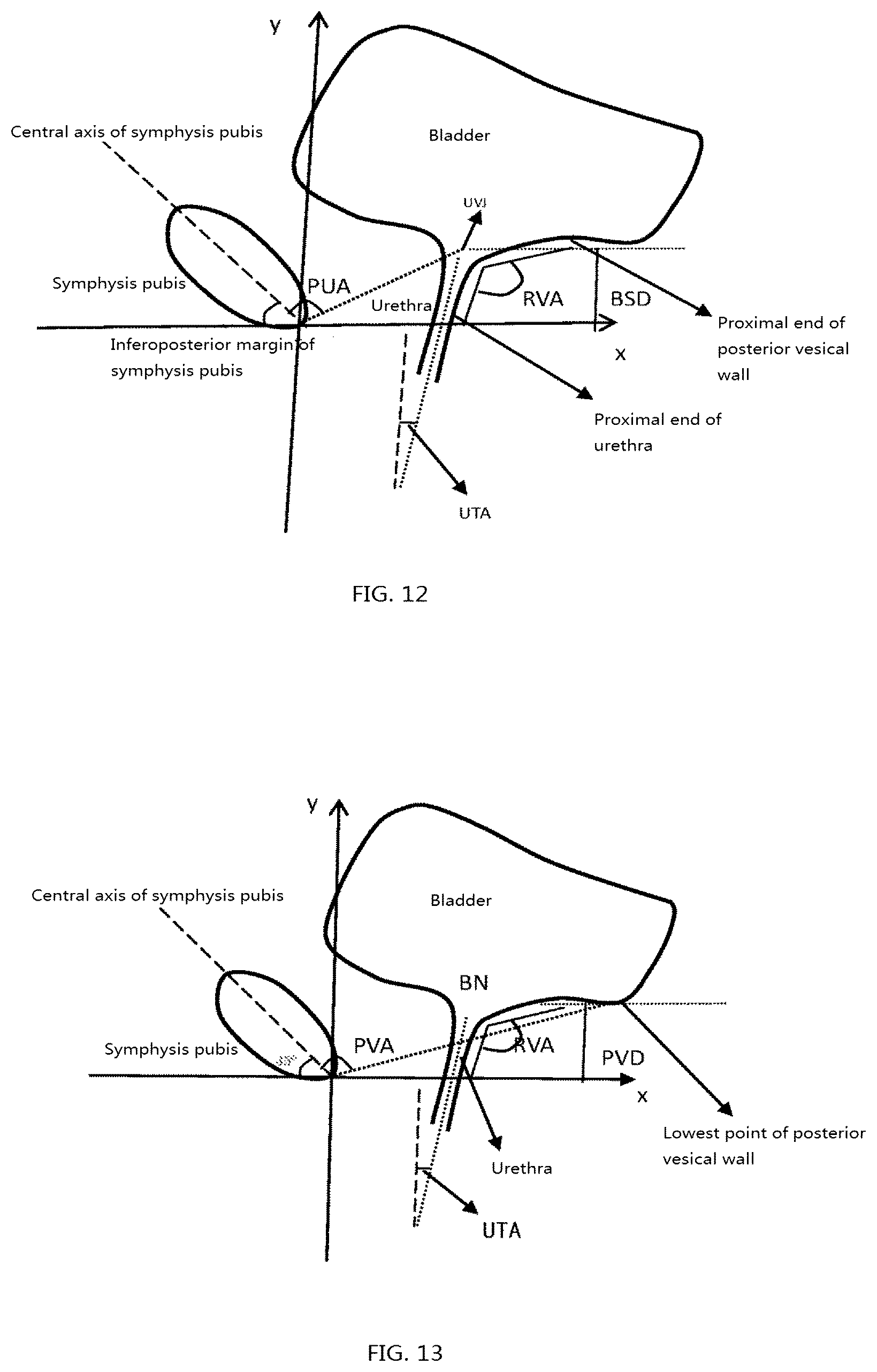 Patent US12318246 Figure 6 – Method for measuring parameters in ultrasonic image and ultrasonic imaging system