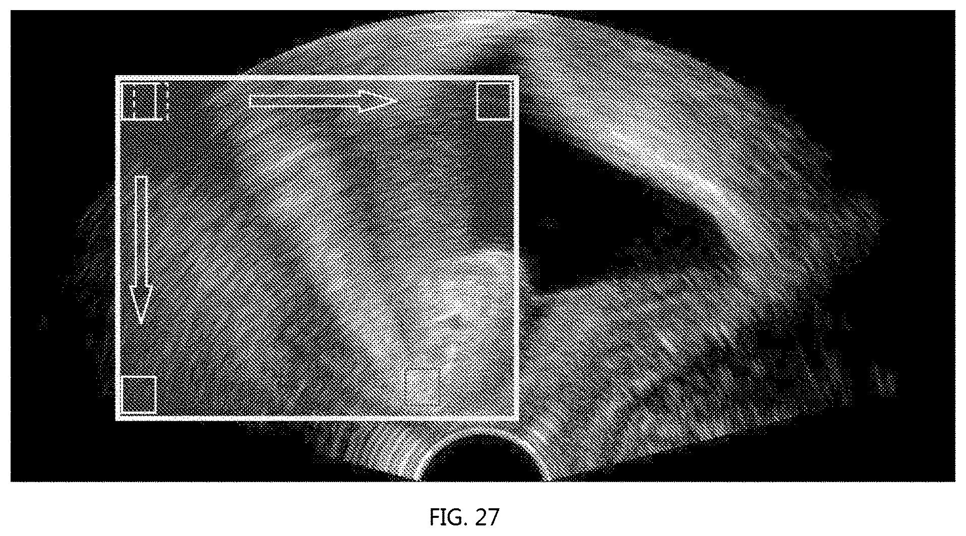 Patent US12318246 Figure 13 – Method for measuring parameters in ultrasonic image and ultrasonic imaging system