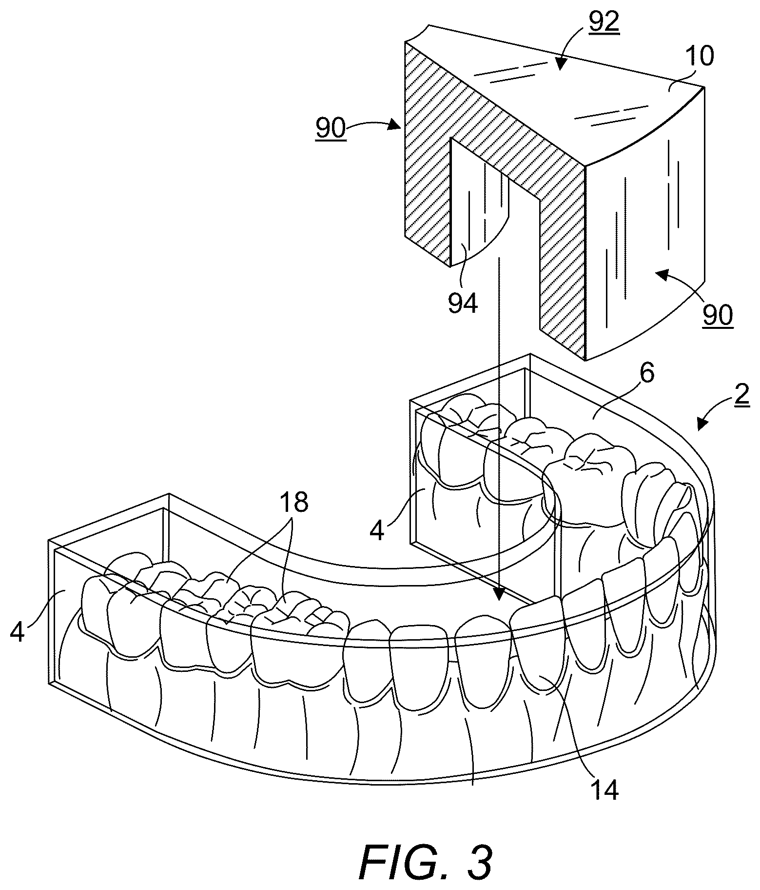 Patent US12318247 Figure 3 – Early dental caries detection system and method