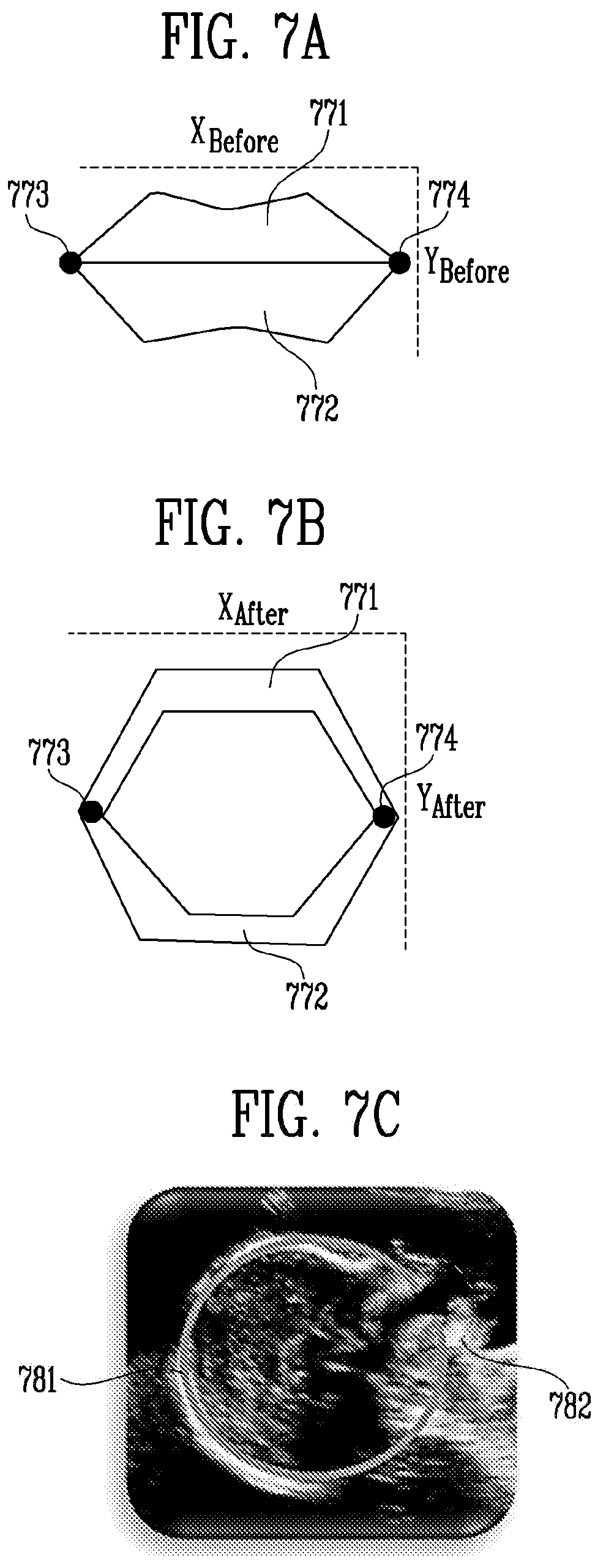 Patent US12318248 Figure 9 – Ultrasound diagnosis apparatus and diagnosis method