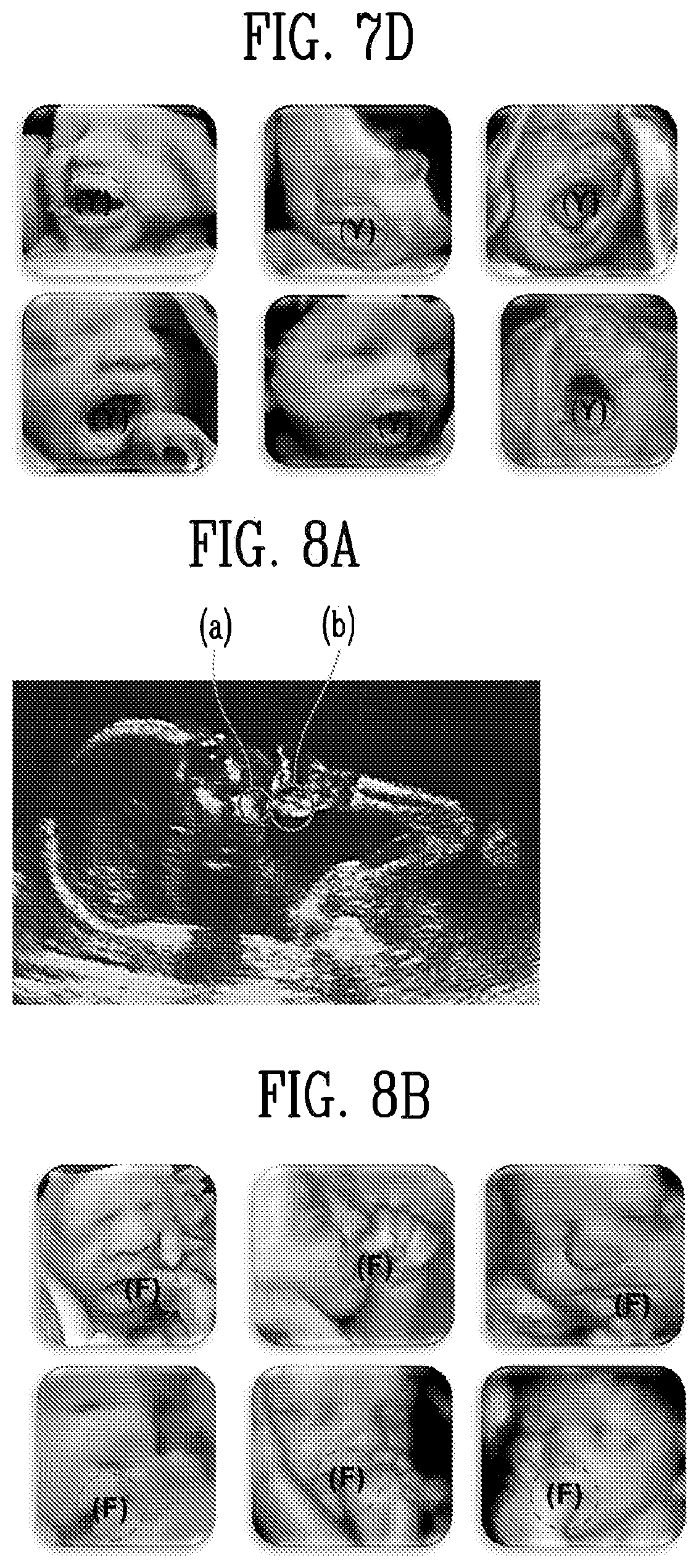Patent US12318248 Figure 10 – Ultrasound diagnosis apparatus and diagnosis method