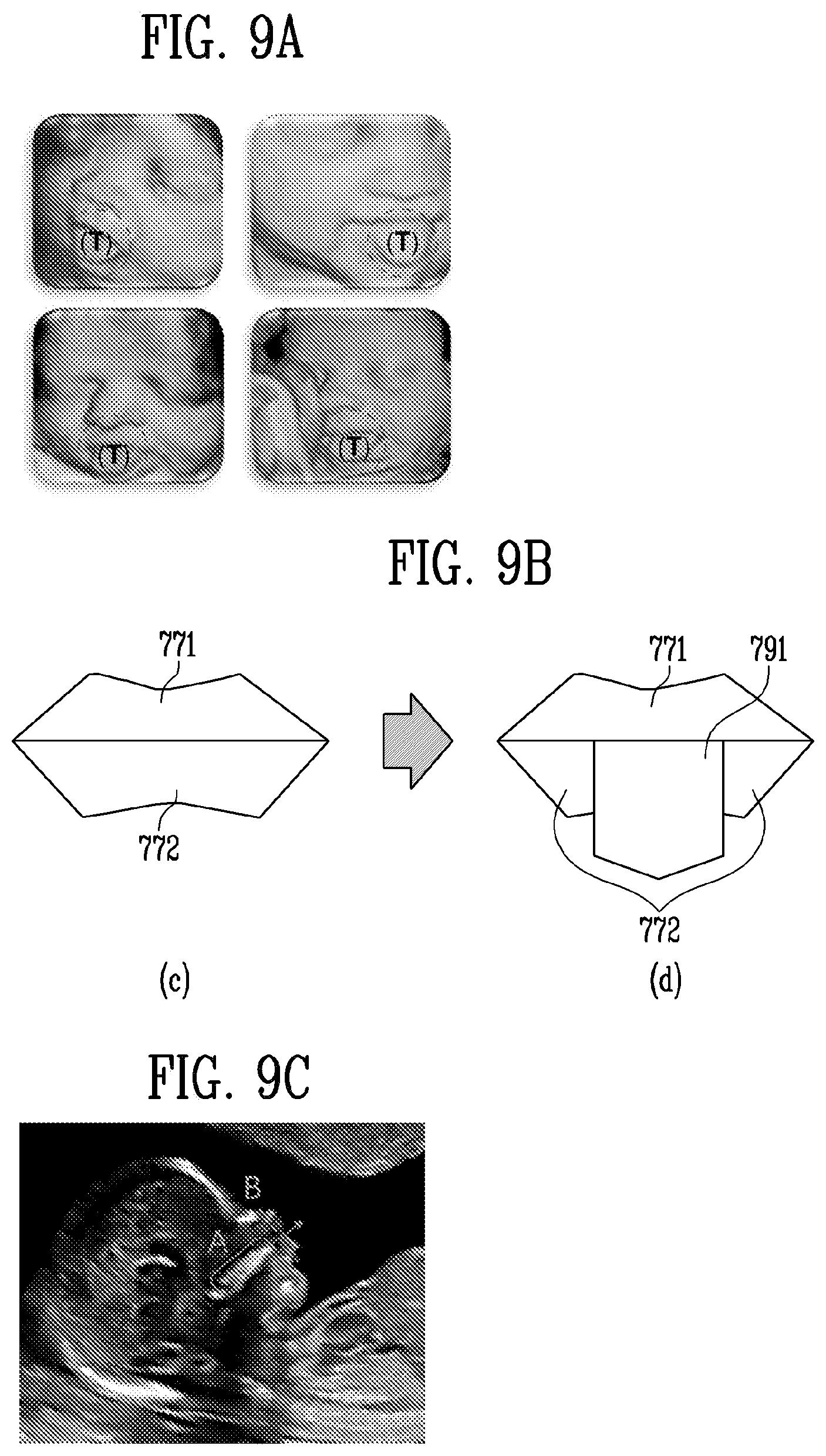 Patent US12318248 Figure 11 – Ultrasound diagnosis apparatus and diagnosis method