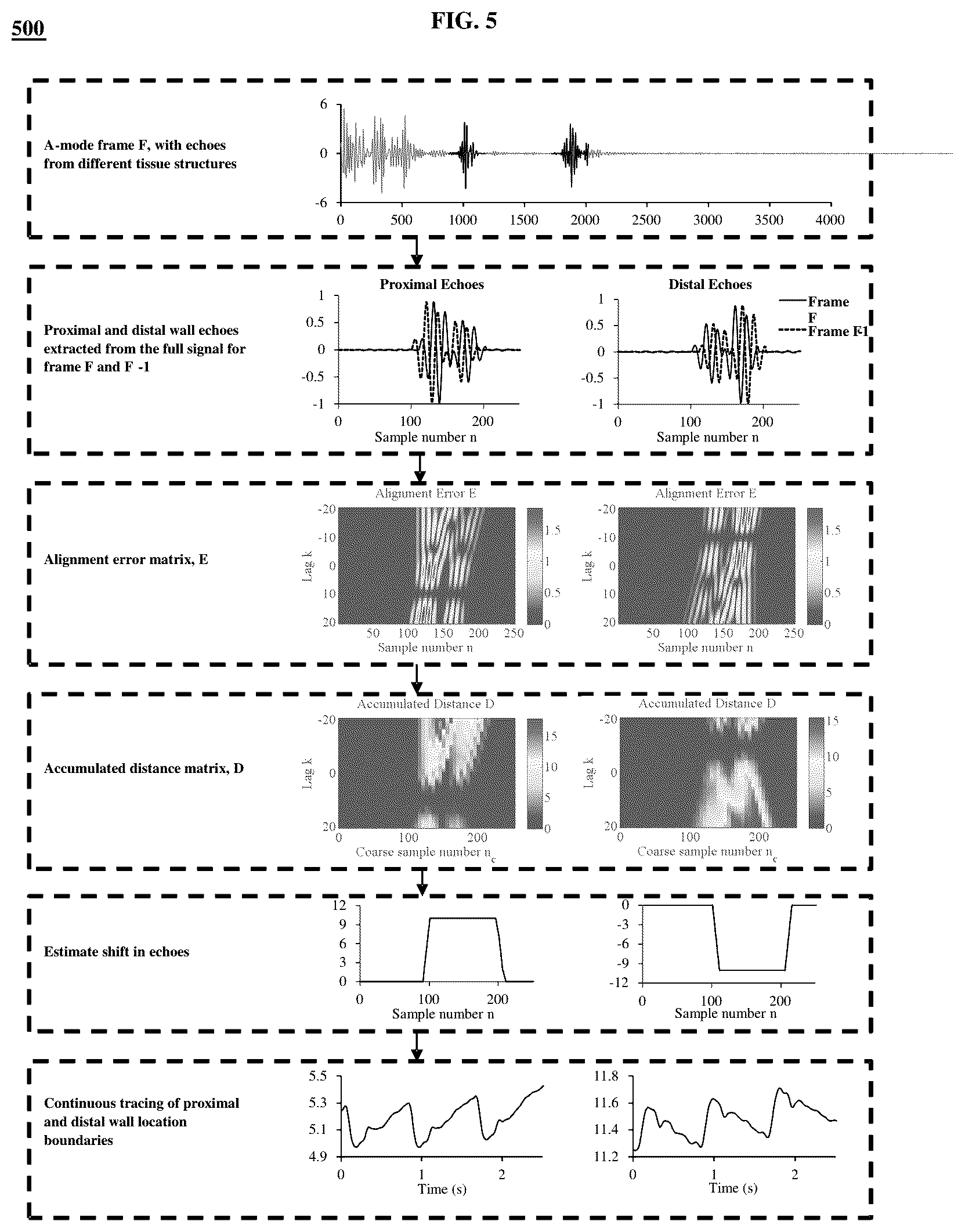Patent US12318250 Figure 5 – Method and device for tracing the motion of blood vessel boundaries