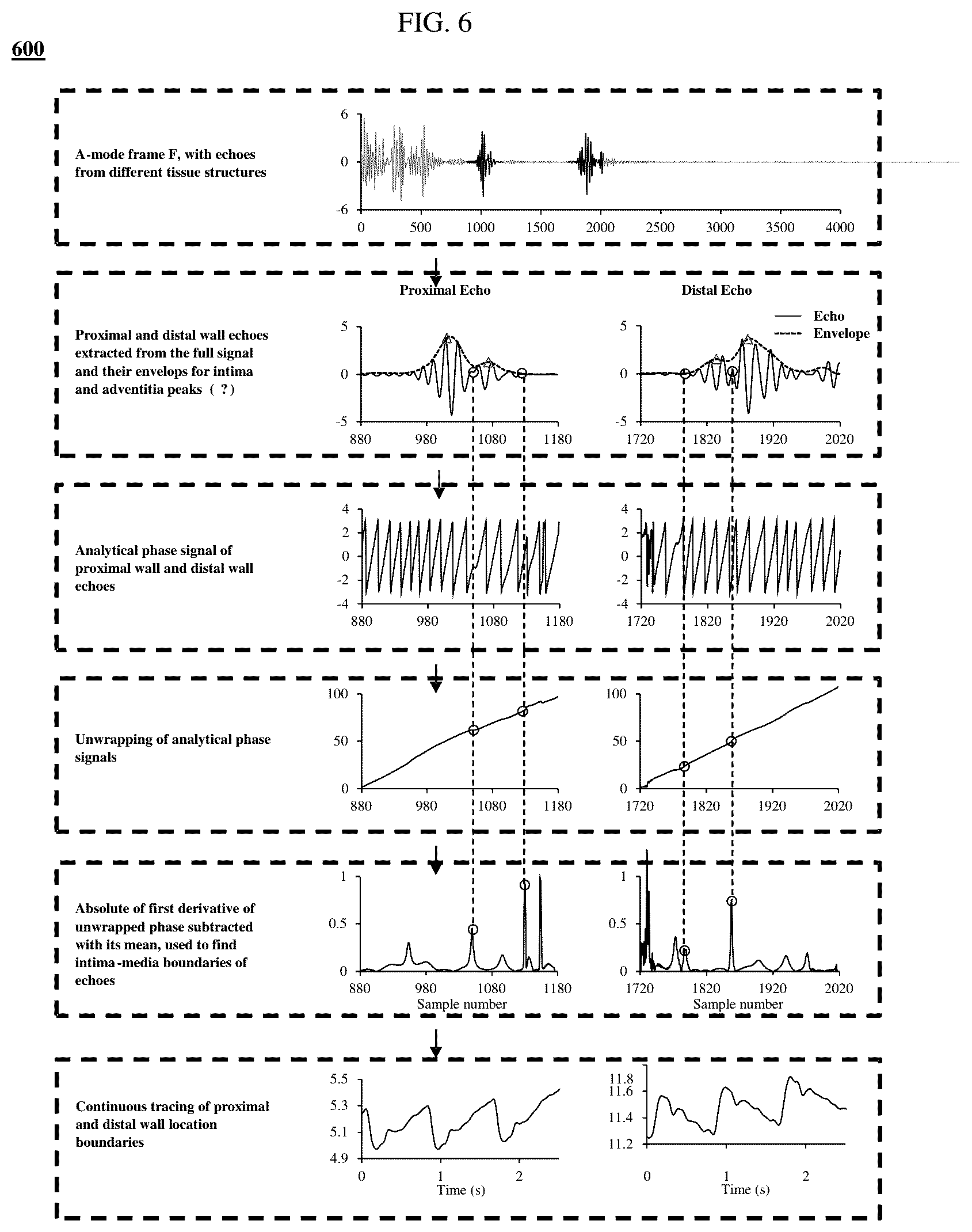 Patent US12318250 Figure 6 – Method and device for tracing the motion of blood vessel boundaries