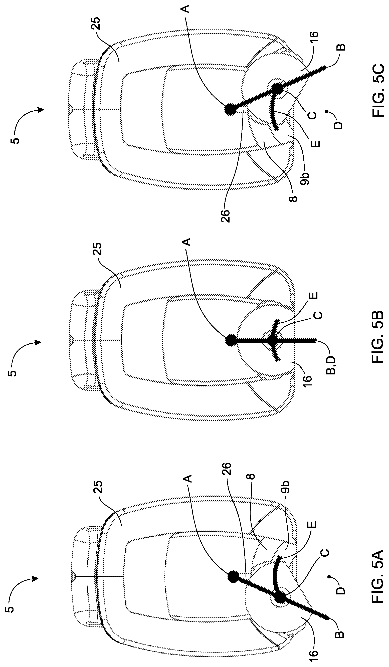 Patent US12318251 Figure 5 – Actuator for ultrasound transducer
