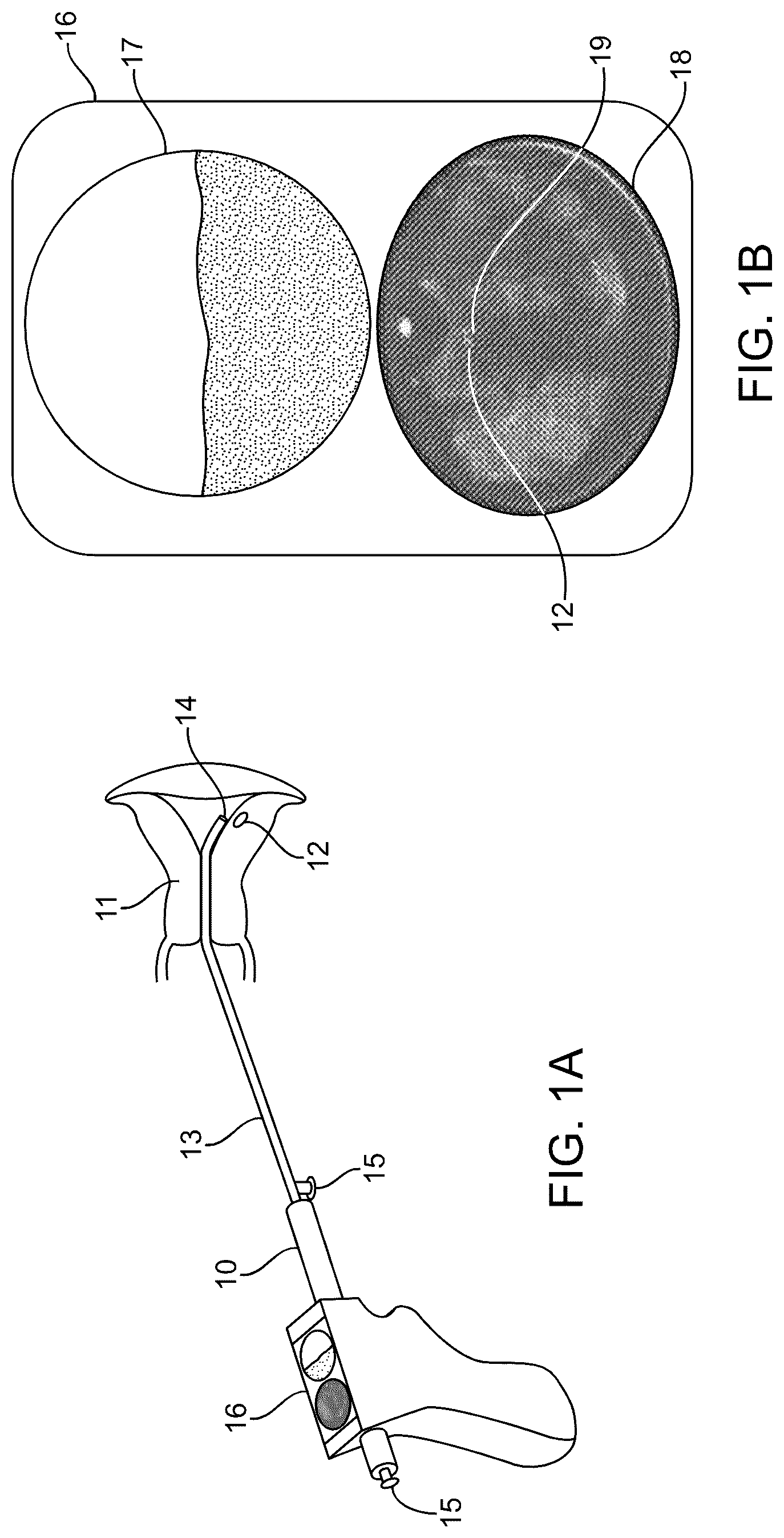 Patent US12318252 Figure 1 – Combined ultrasonic and direct visual hysteroscope