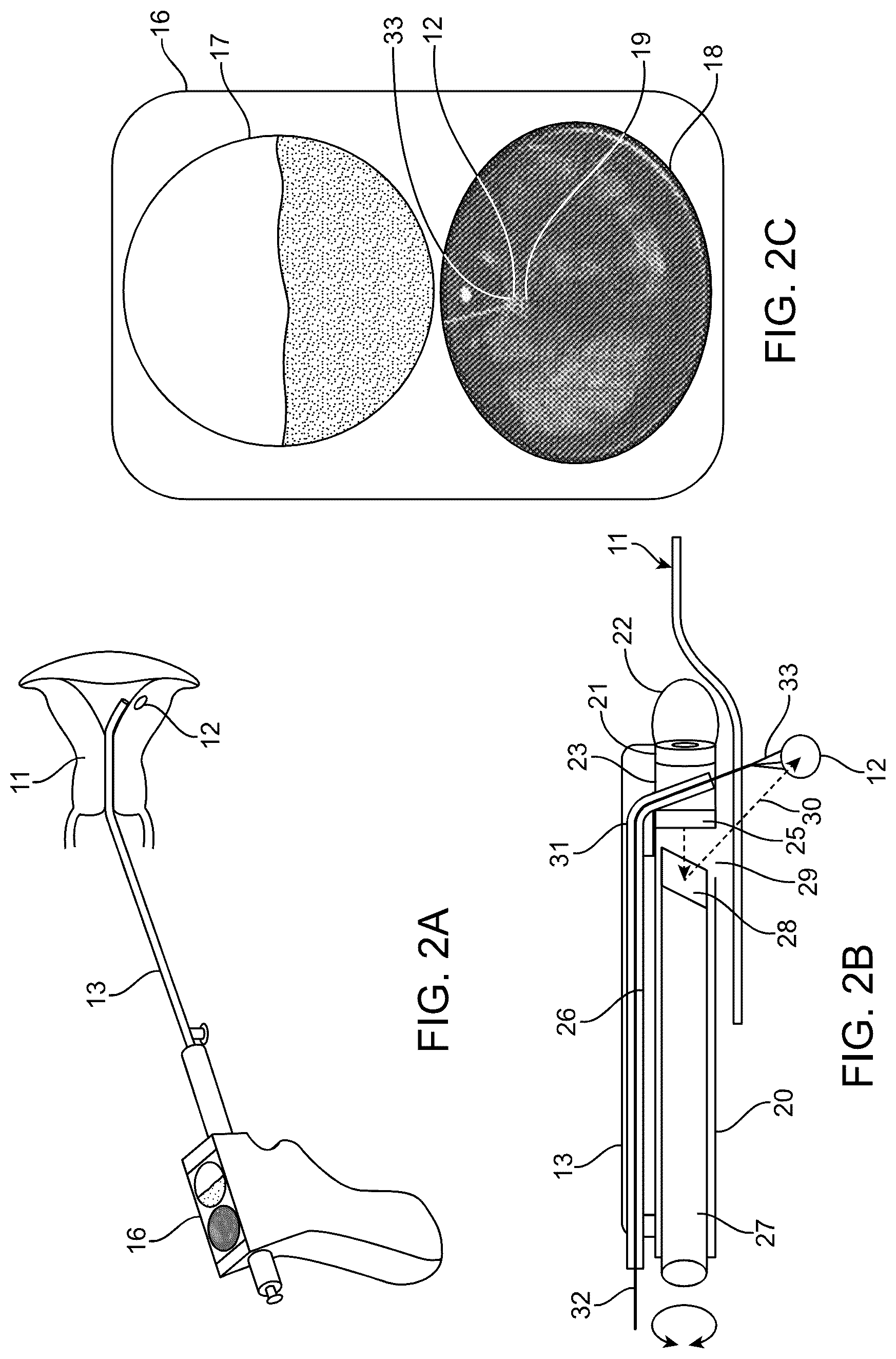 Patent US12318252 Figure 2 – Combined ultrasonic and direct visual hysteroscope